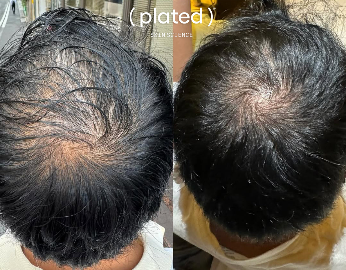 Plated Skin Science HAIR Serum (1 oz)