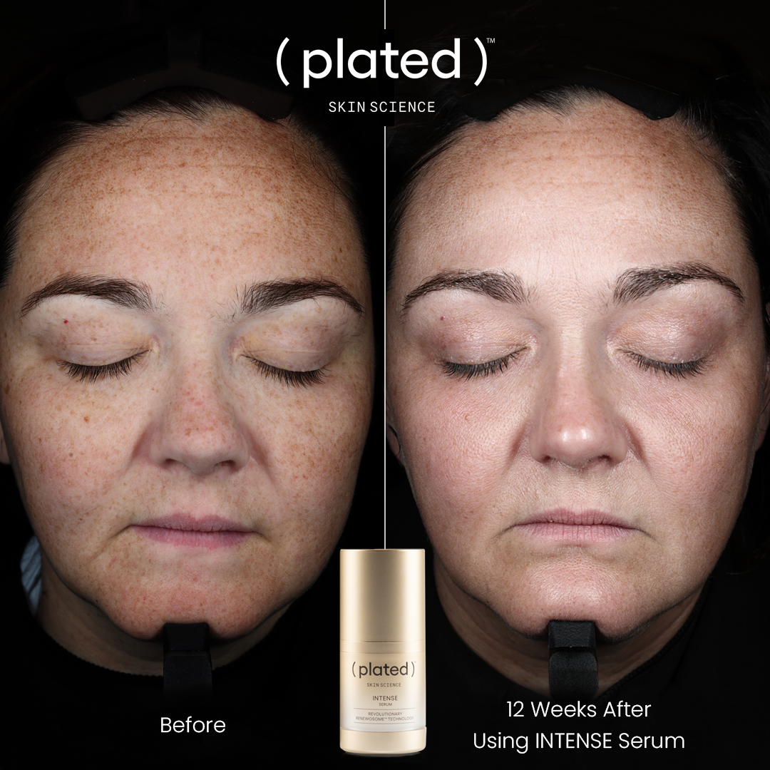Plated Skin Science INTENSE Serum (0.5 oz)