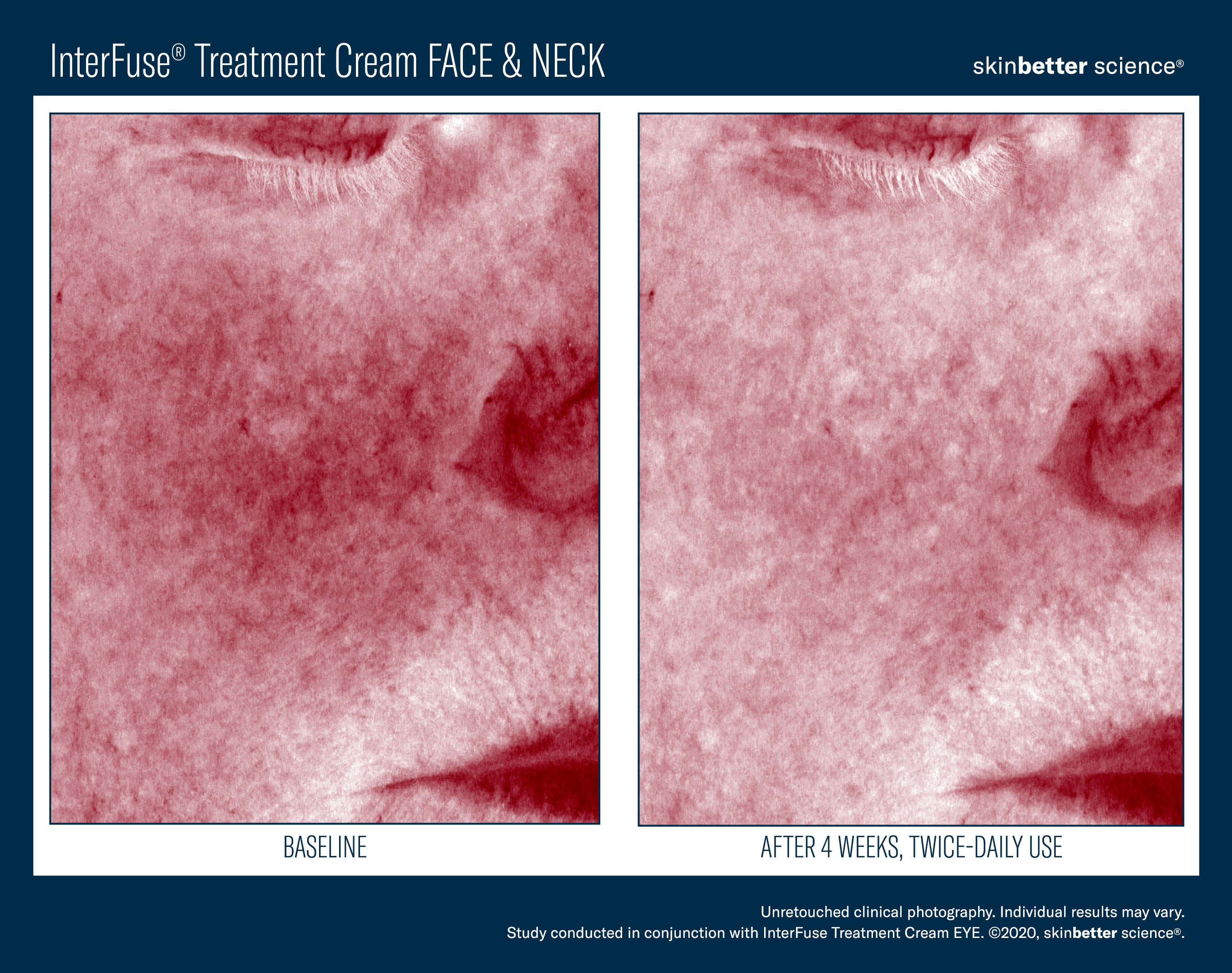 SkinBetter Science Travel Size InterFuse Treatment Cream Face & Neck (0.17 oz)