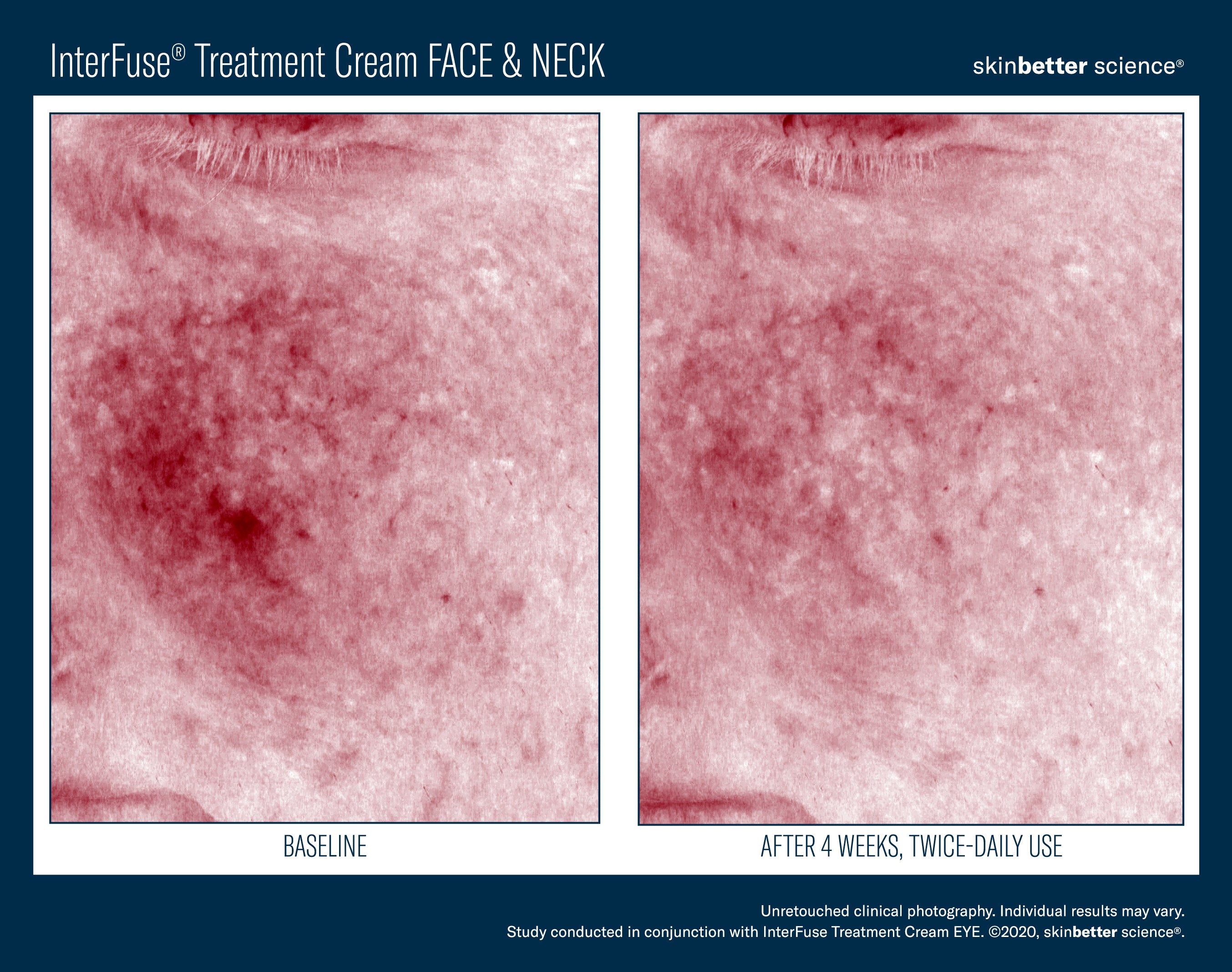 SkinBetter Science Travel Size InterFuse Treatment Cream Face & Neck (0.17 oz)