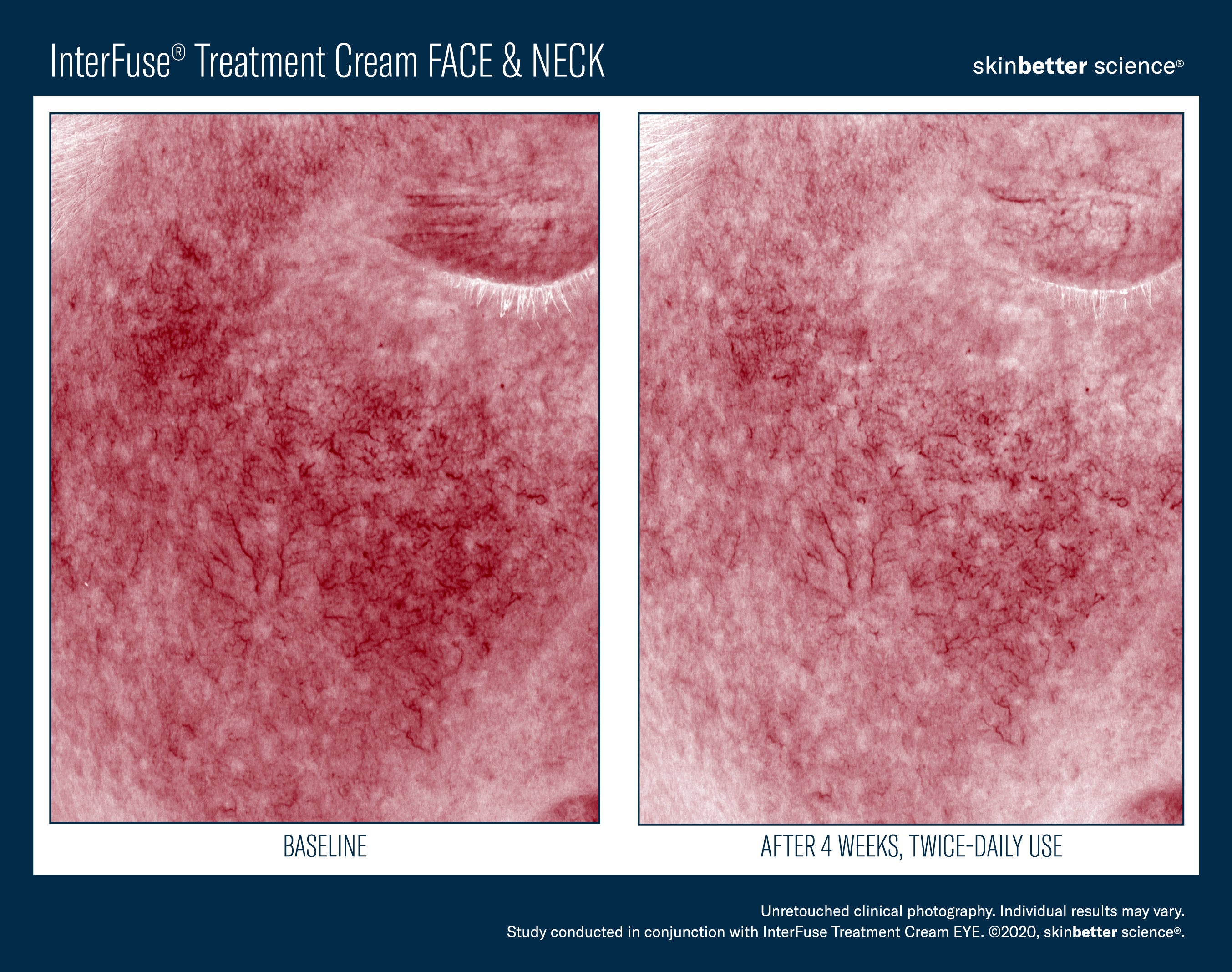 SkinBetter Science Travel Size InterFuse Treatment Cream Face & Neck (0.17 oz)