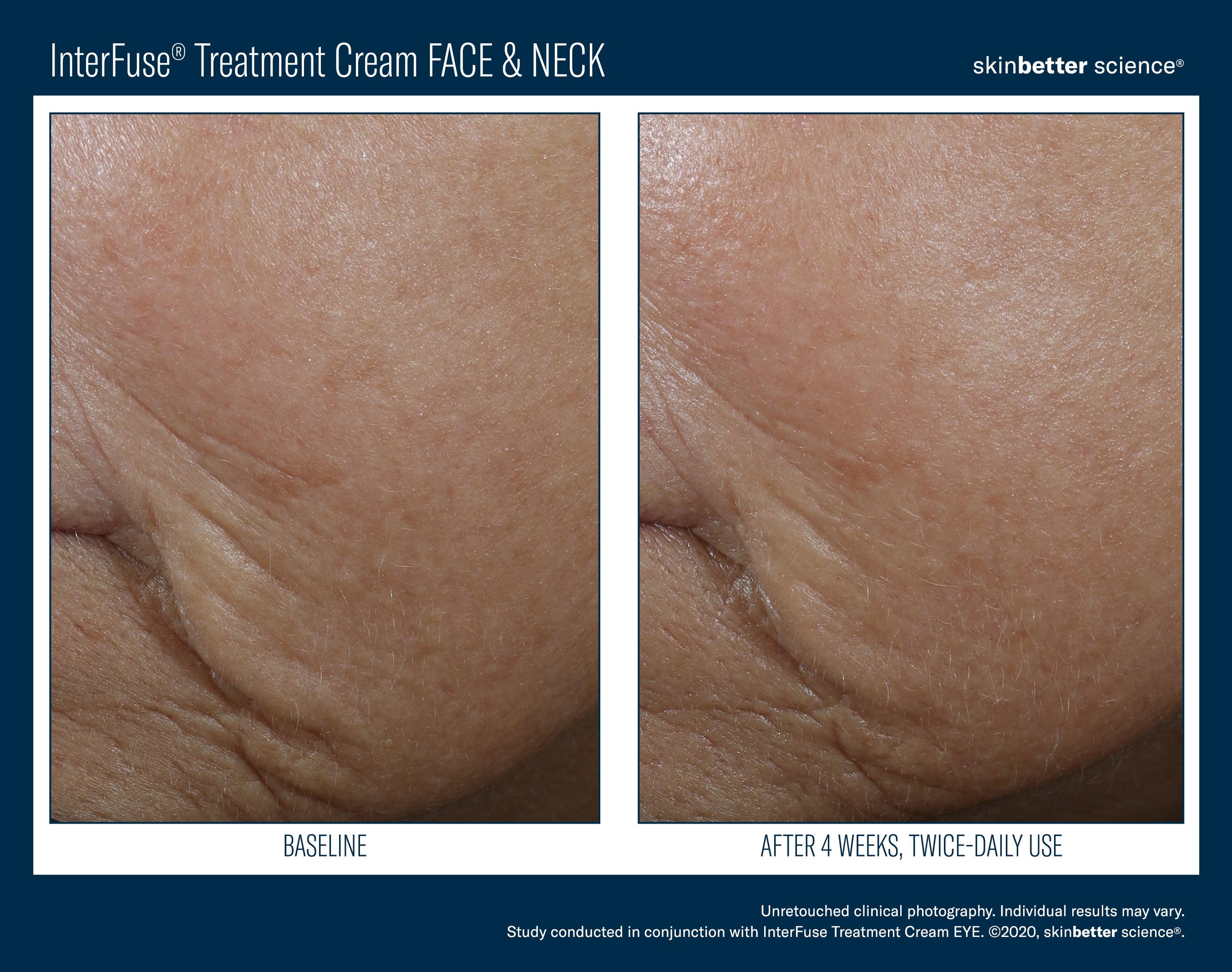 SkinBetter Science InterFuse Treatment Cream Face & Neck (1.69 oz)