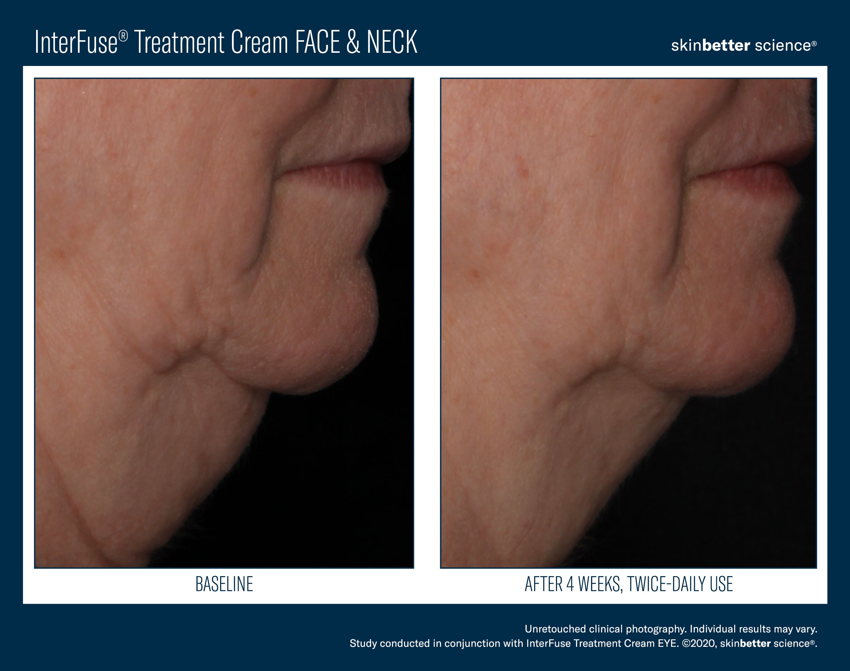 SkinBetter Science Travel Size InterFuse Treatment Cream Face & Neck (0.17 oz)