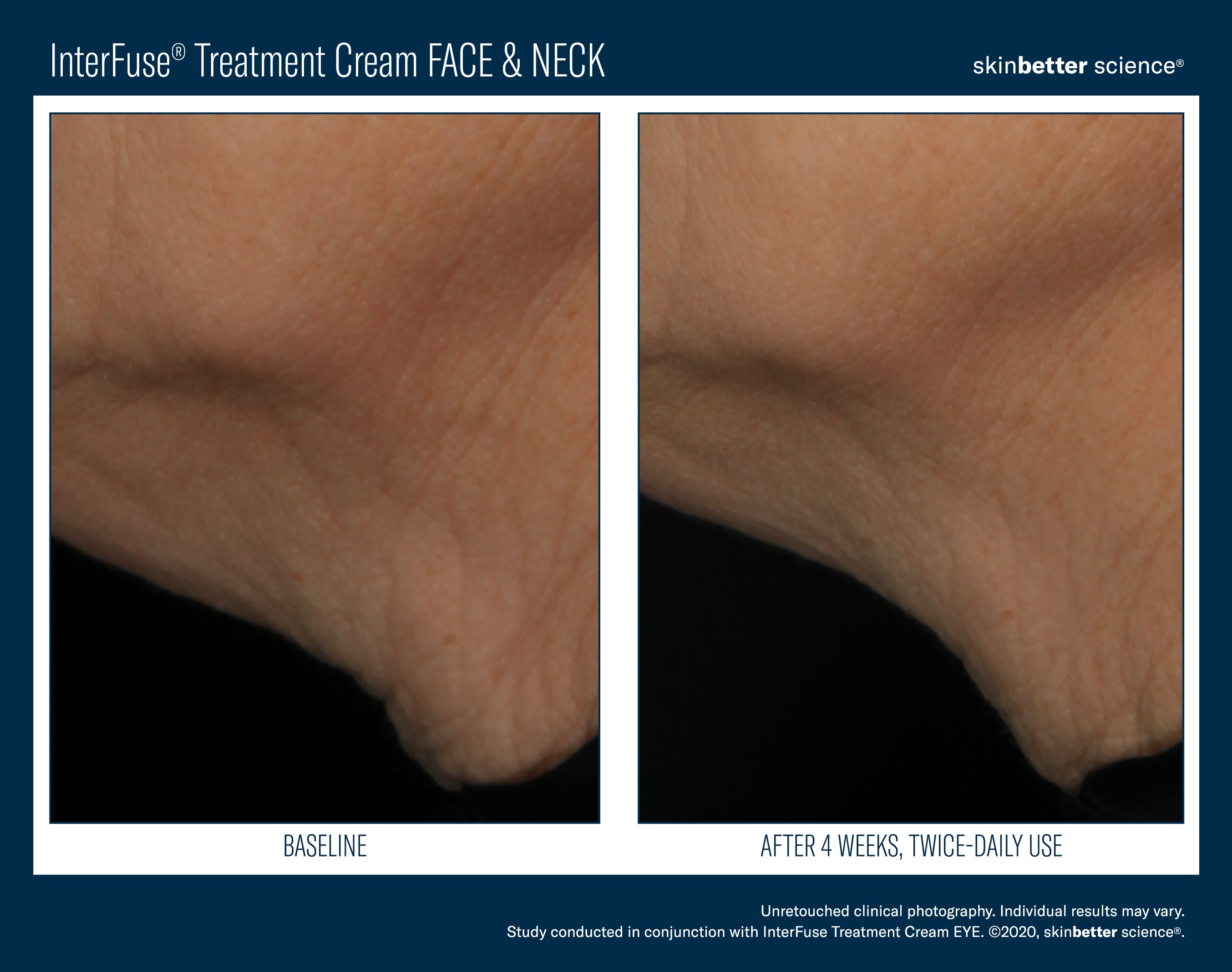 SkinBetter Science Travel Size InterFuse Treatment Cream Face & Neck (0.17 oz)