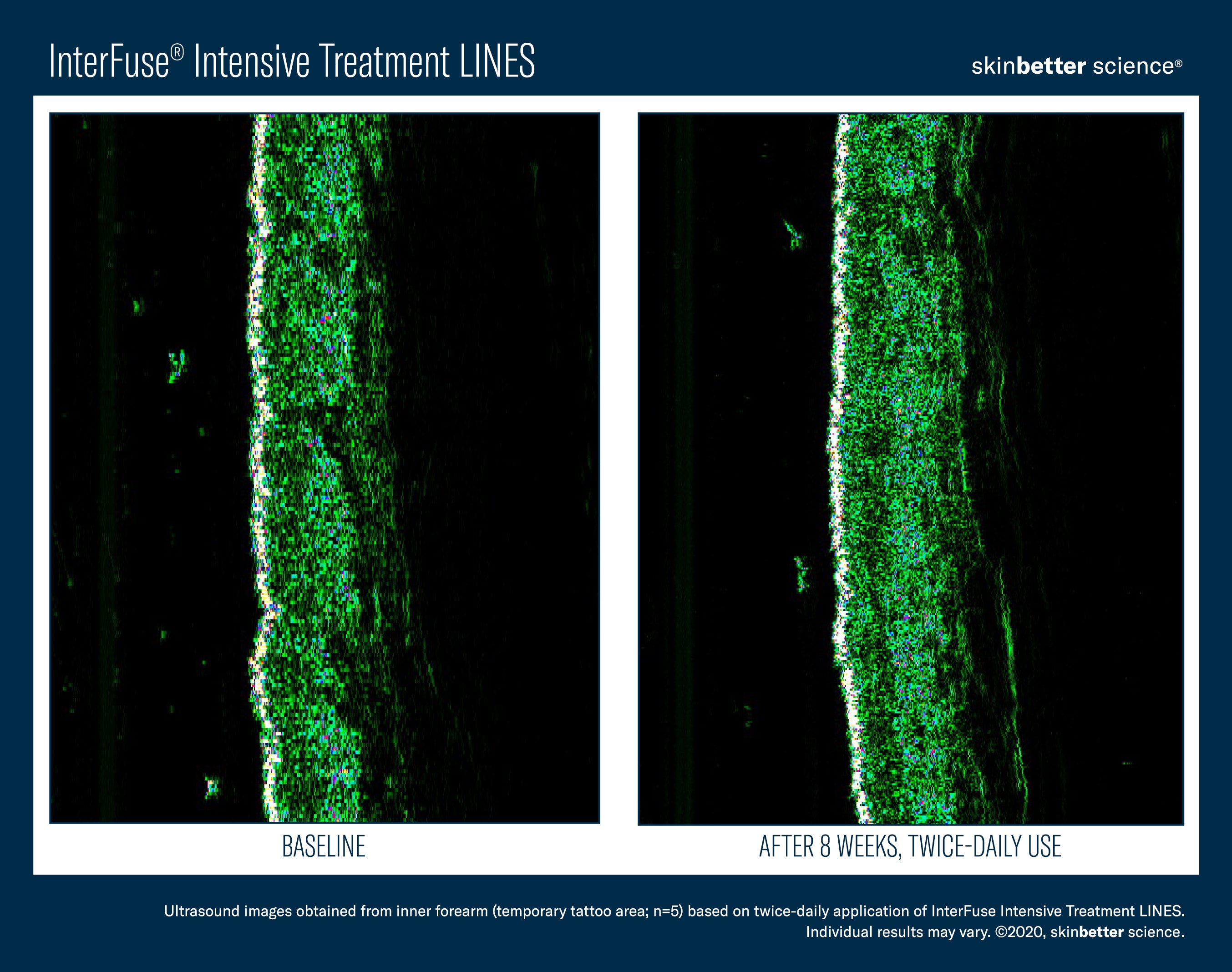SkinBetter Science InterFuse Intensive Treatment Lines (1 oz)