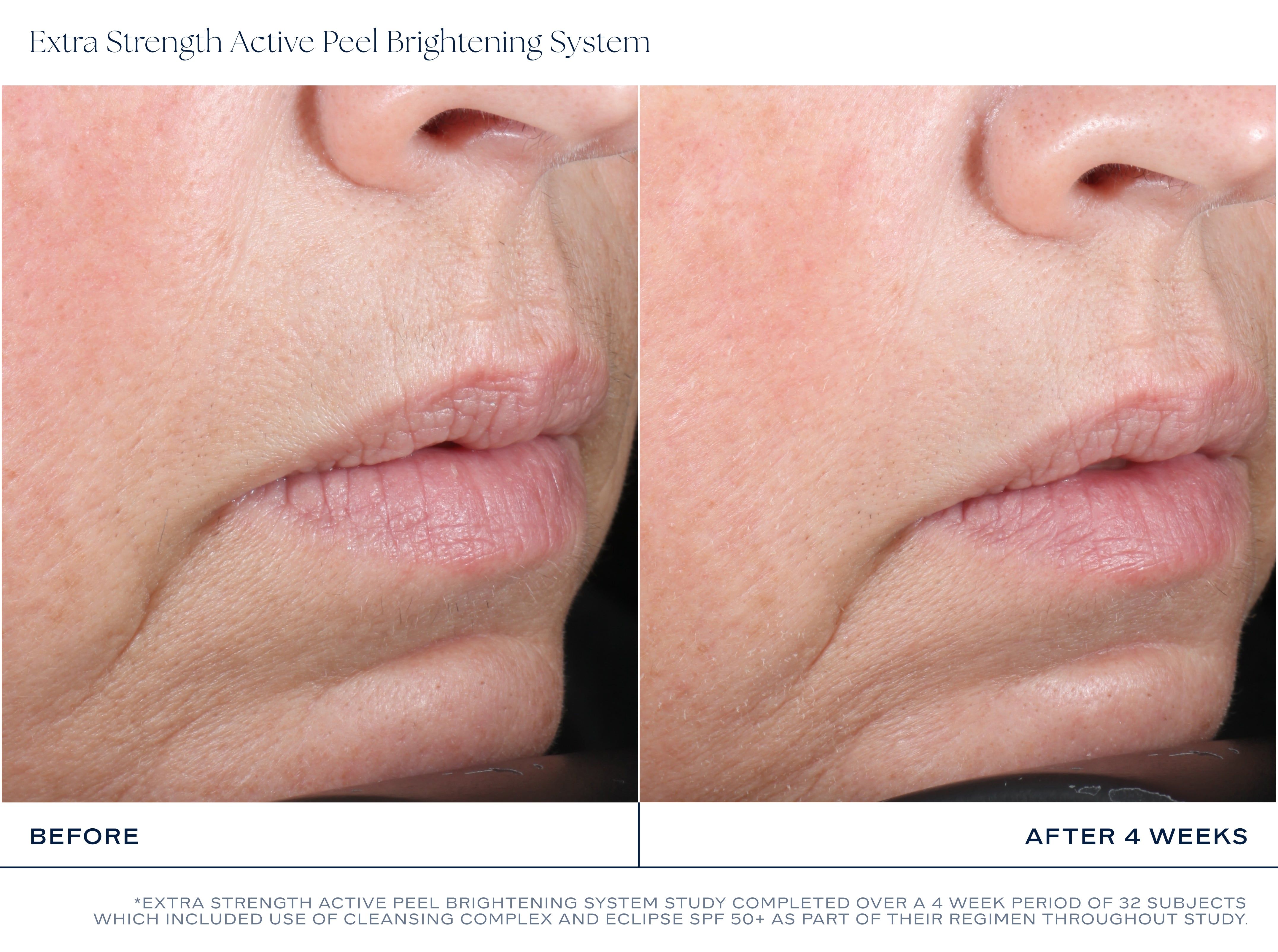 iS Clinical Extra Strength Active Peel Brightening System