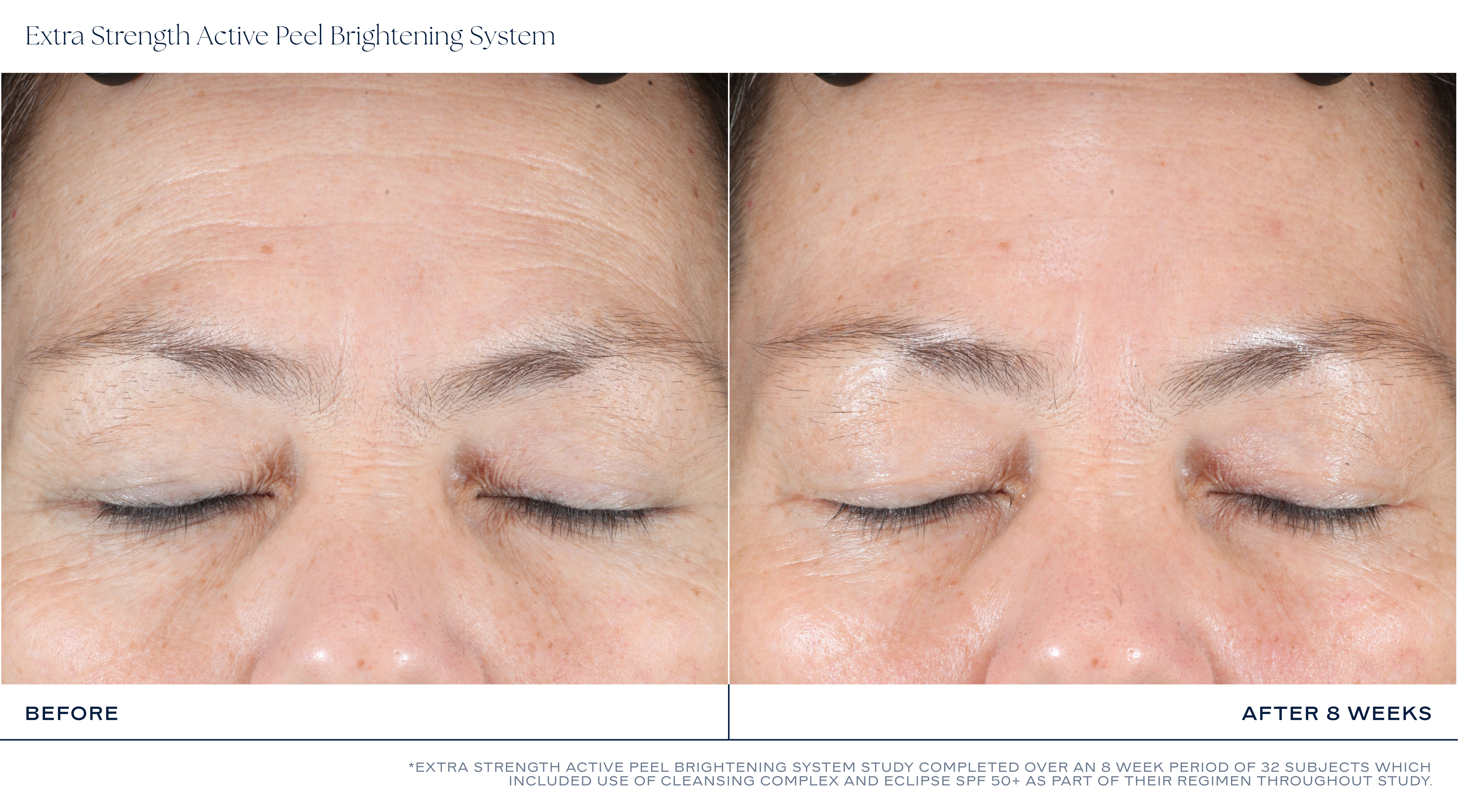 iS Clinical Extra Strength Active Peel Brightening System