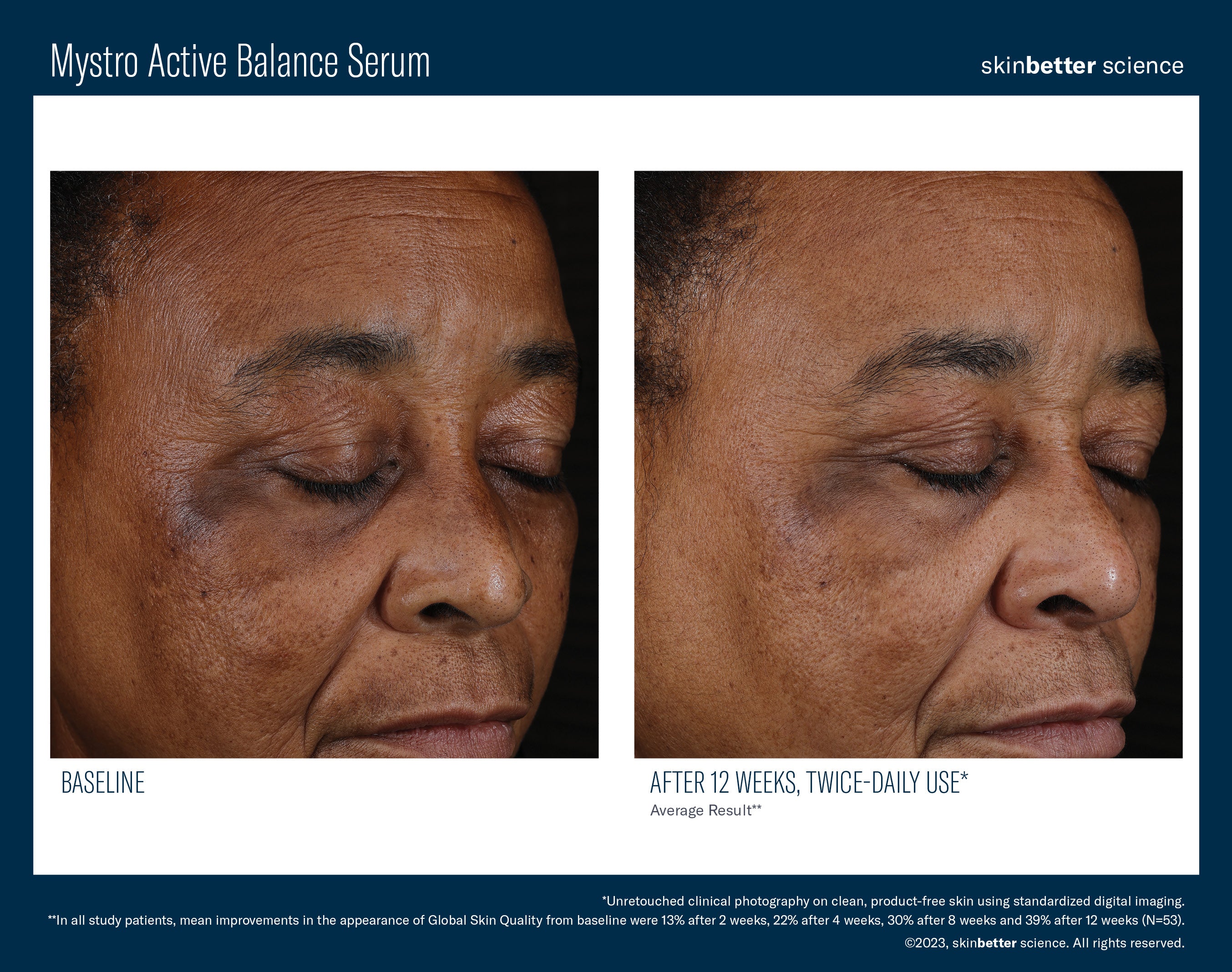 SkinBetter Science Mystro Active Balance Serum (1 oz)