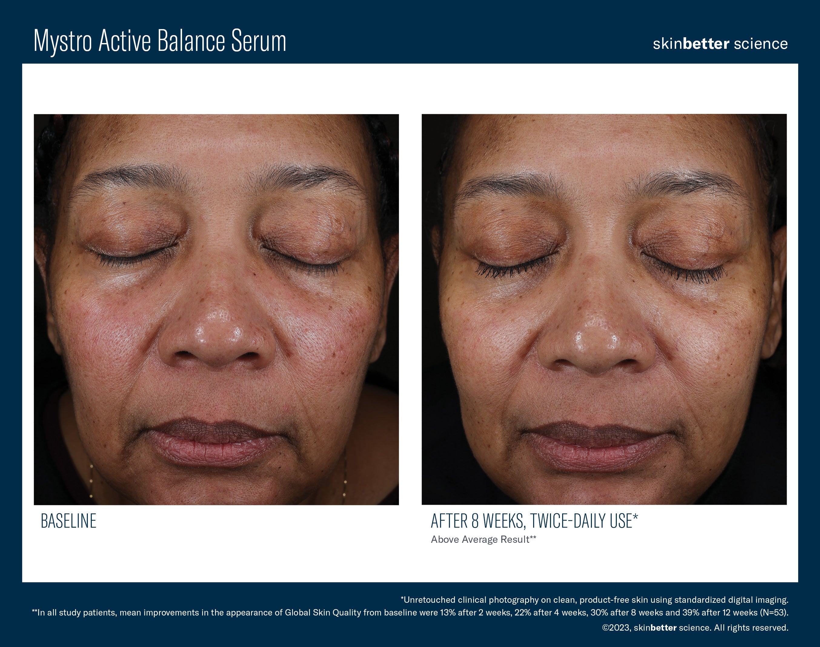 SkinBetter Science Mystro Active Balance Serum (1 oz)