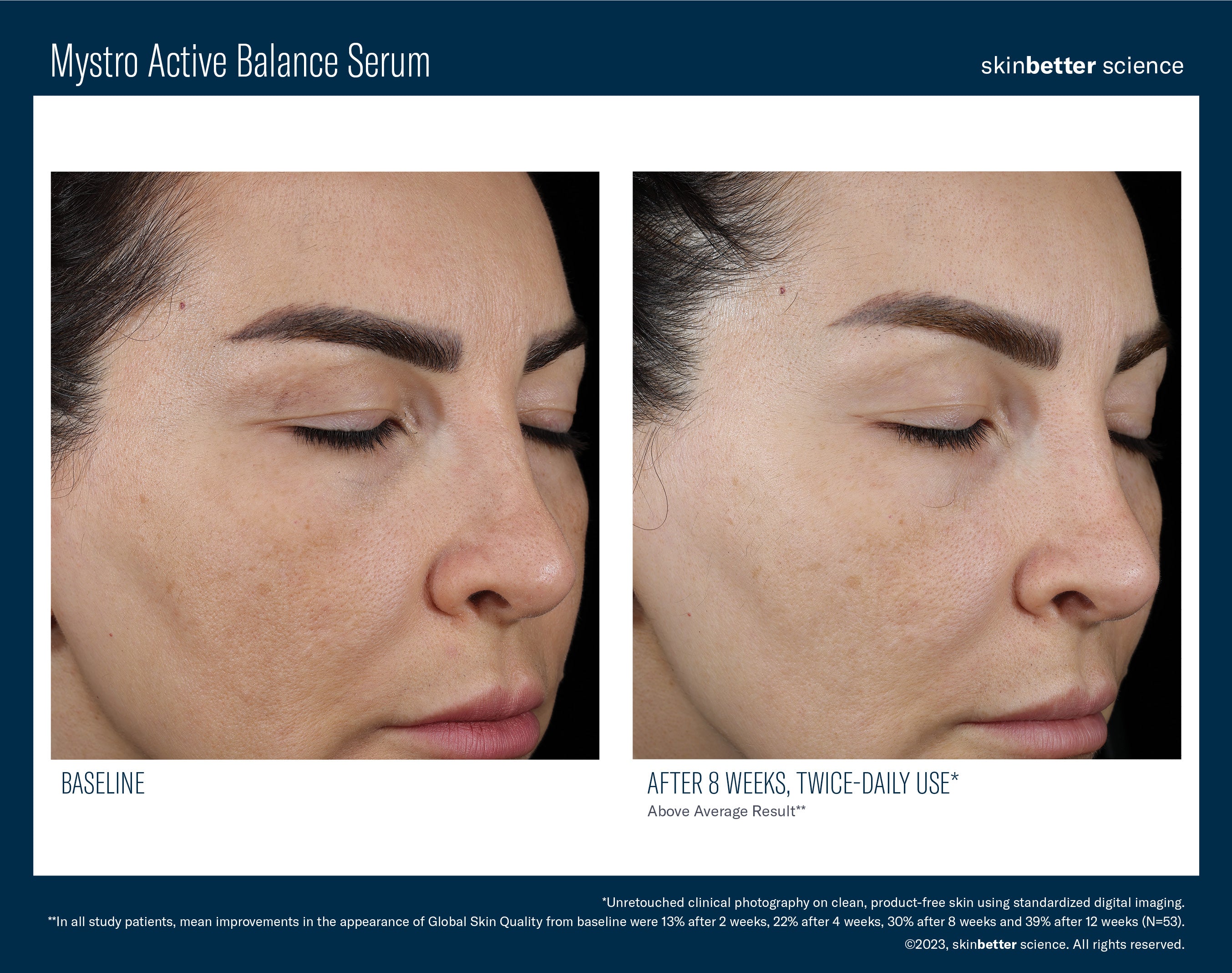 SkinBetter Science Mystro Active Balance Serum (1.7 oz)