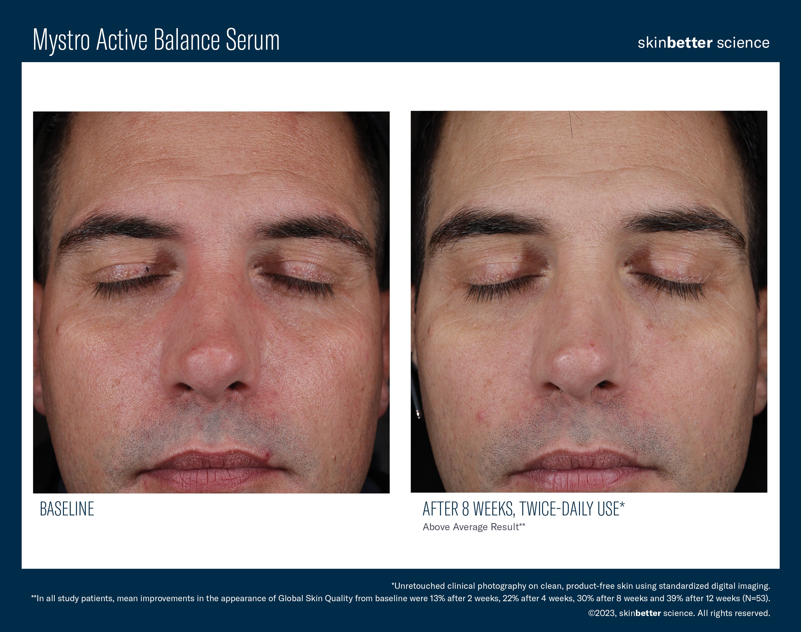 SkinBetter Science Mystro Active Balance Serum (0.5 oz)