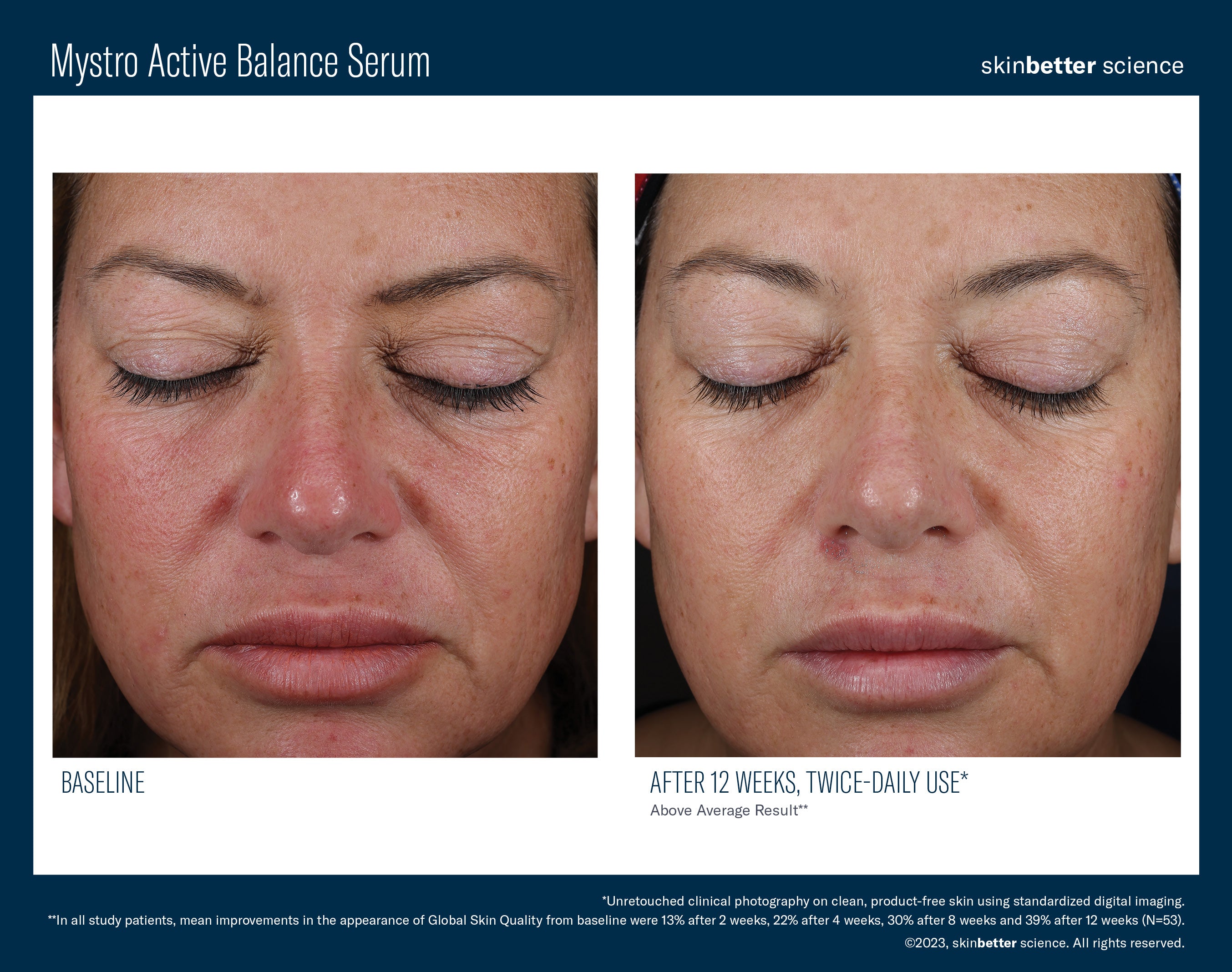 SkinBetter Science Mystro Active Balance Serum (1.7 oz)