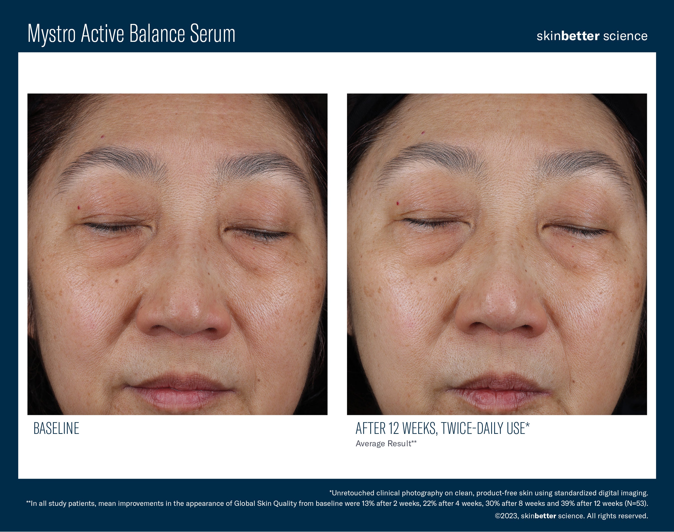 SkinBetter Science Mystro Active Balance Serum (0.5 oz)