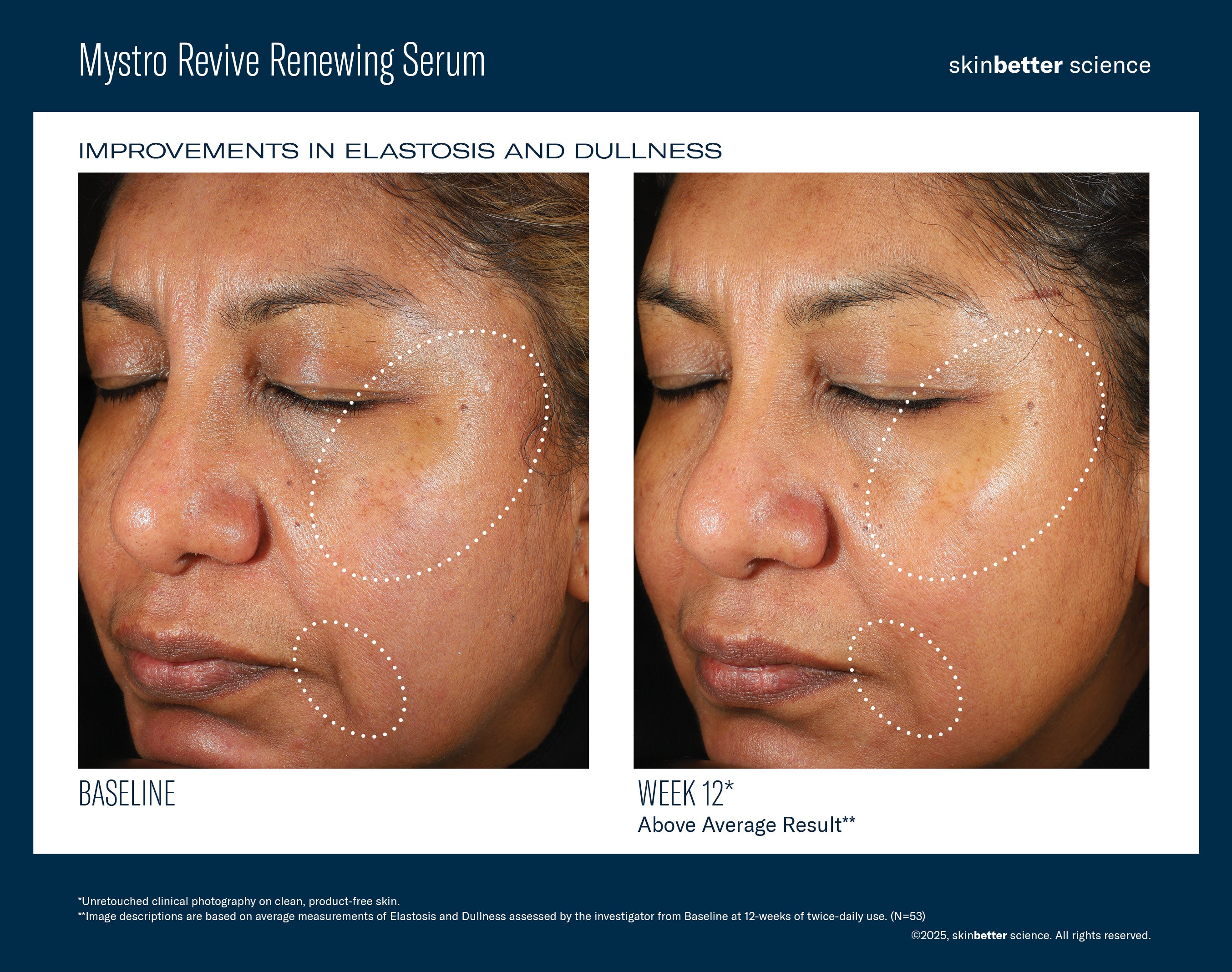 SkinBetter Science Mystro Revive Renewing Serum (1 oz)