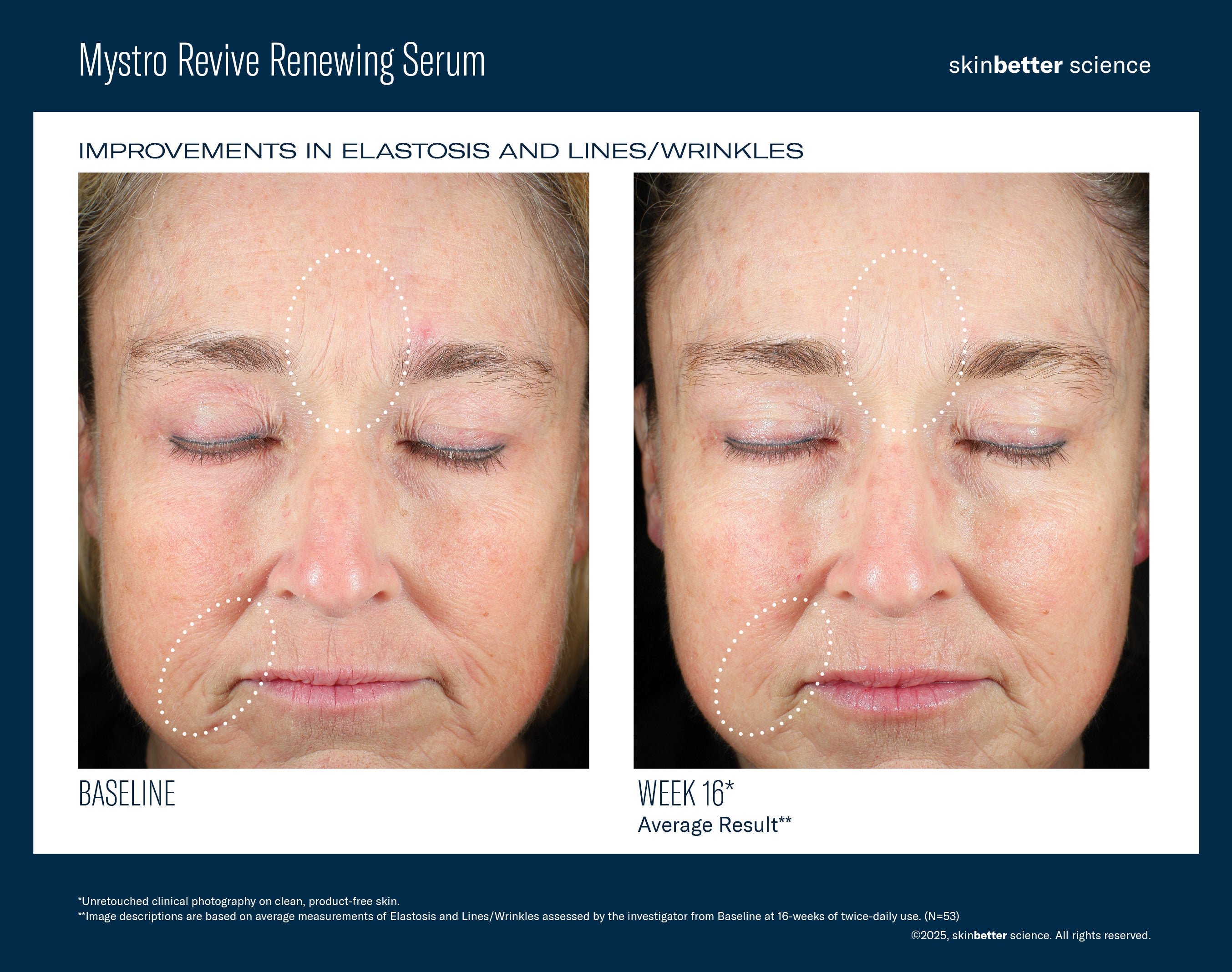 SkinBetter Science Mystro Revive Renewing Serum (1 oz)