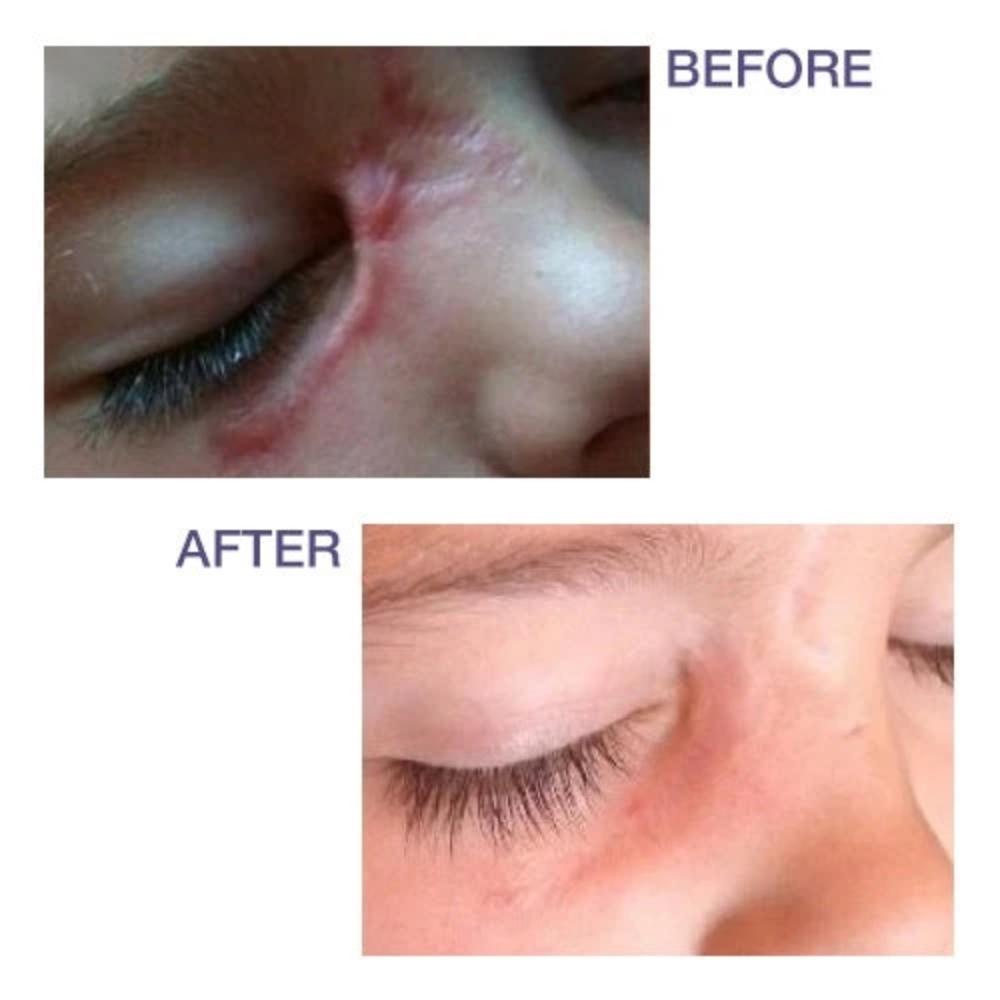 Biodermis Pro-Sil 4.25g