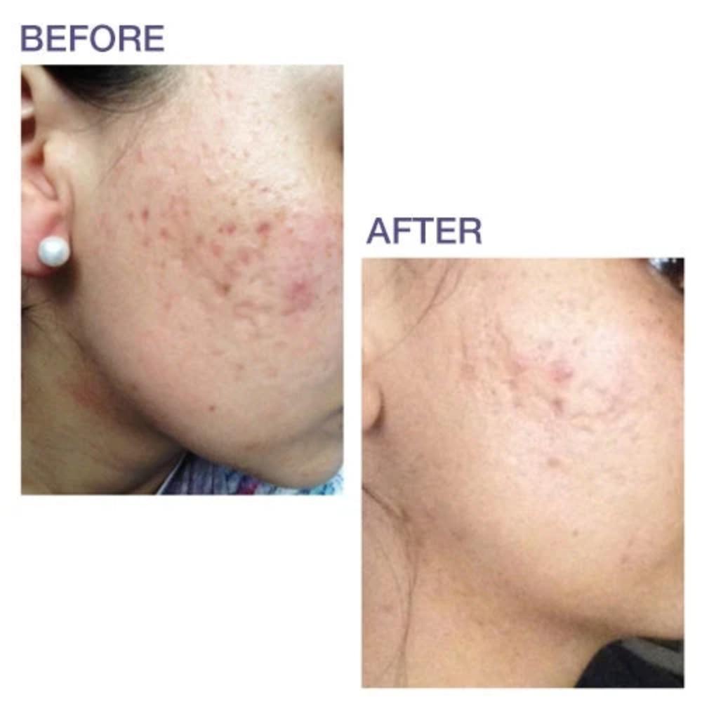 Biodermis Pro-Sil 4.25g