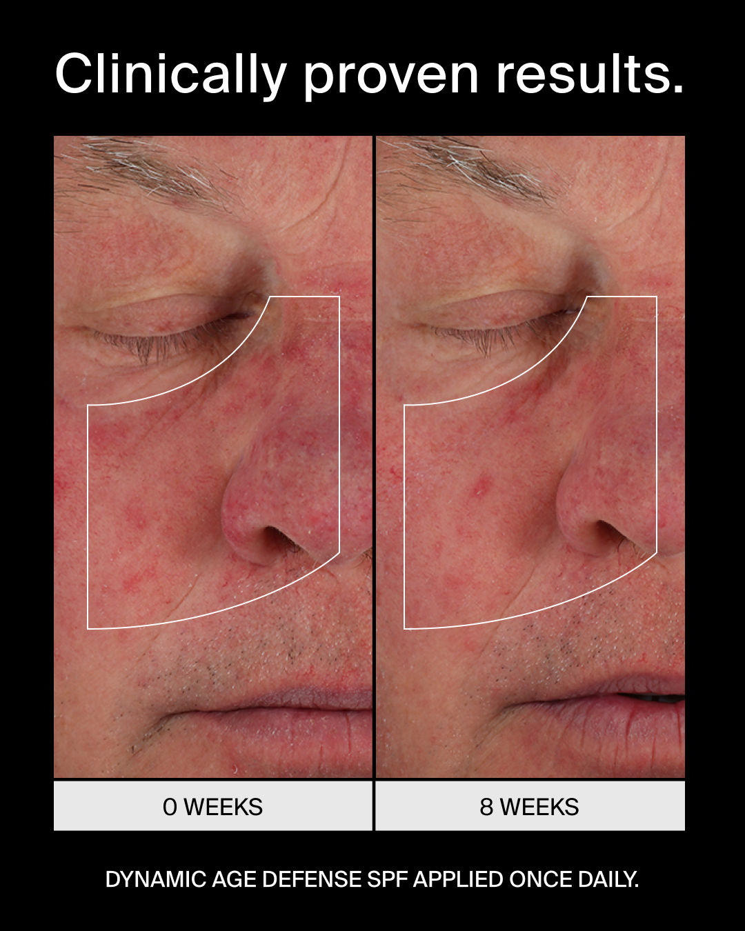 Pavise Dynamic Age Defense SPF 30 (1 oz)