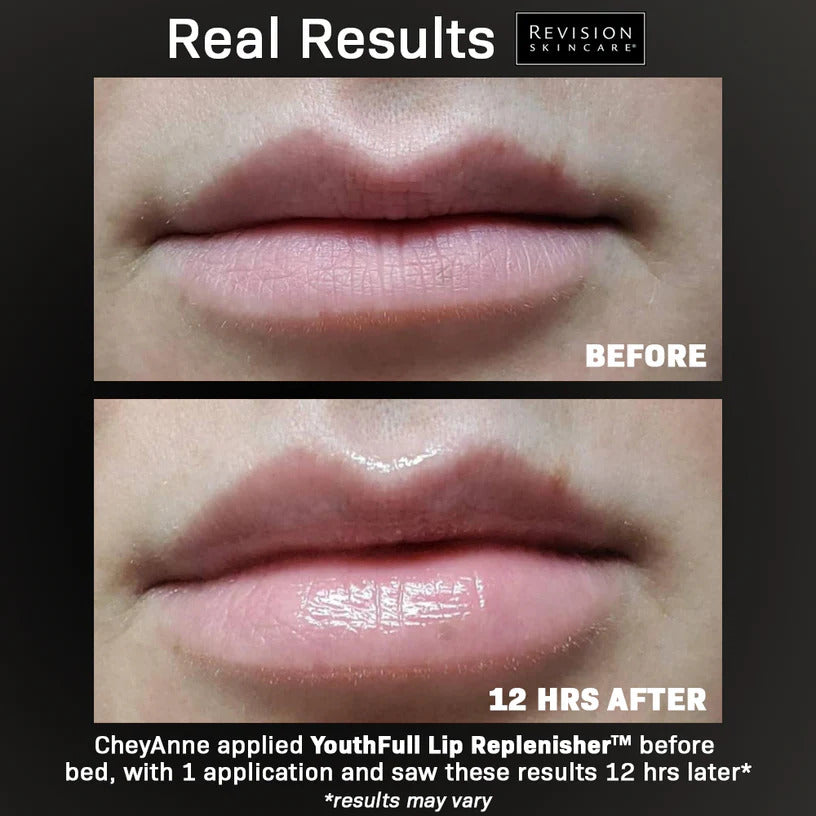 Revision Skincare YouthFull Lip Replenisher® 0.33 oz (2-Pack)
