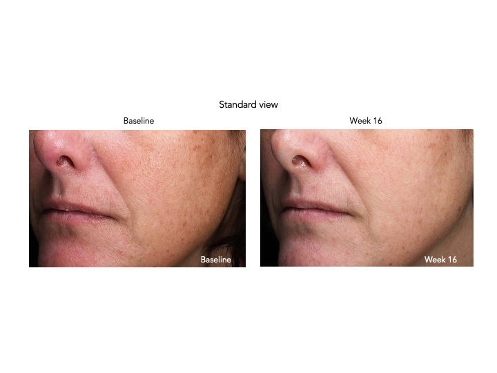 Senté Pigment & Tone Correcting Mask Cysteamine HSA (1.69 oz) & Dermal Repair Cream (0.5 oz) Duo