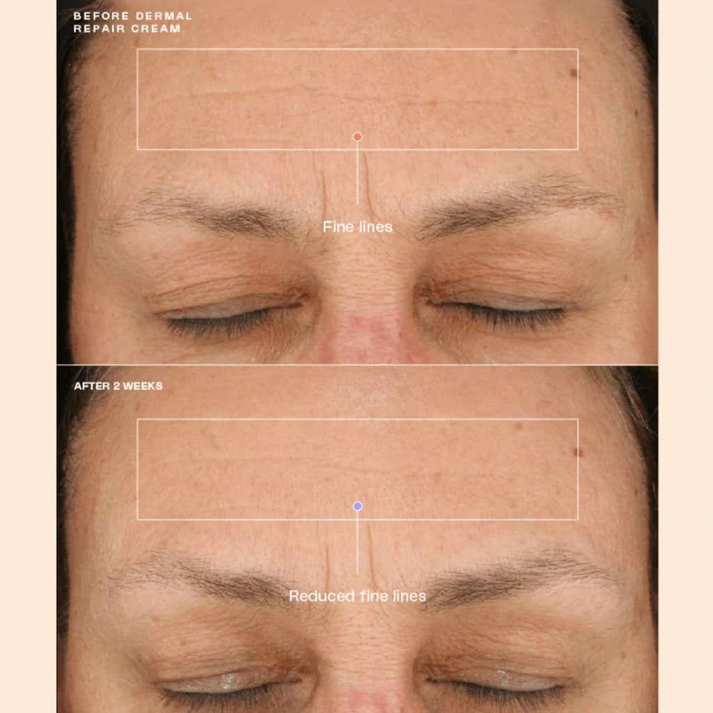 Senté Dermal Repair Cream (1.7 oz) & Bio Complete Serum (0.33 oz) Duo.