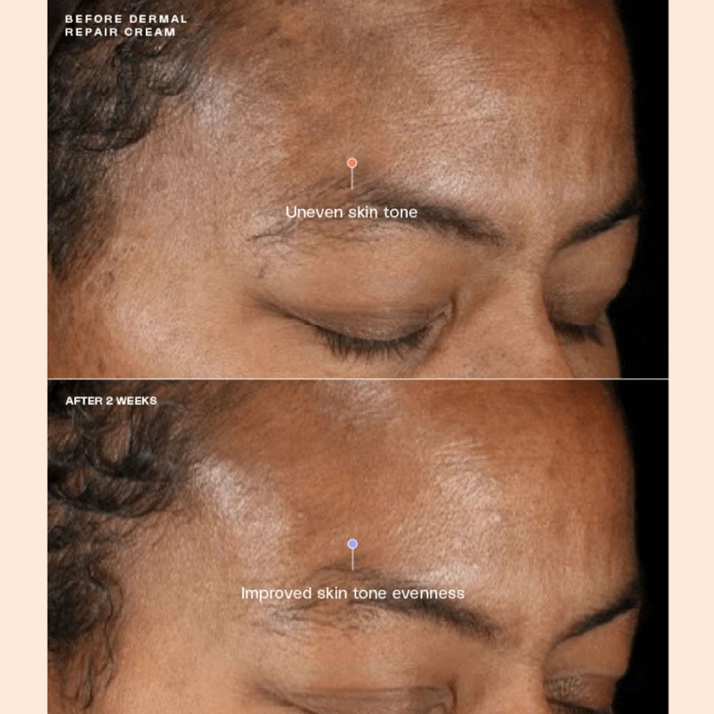 Senté Dermal Repair Cream (1.7 oz) & Bio Complete Serum (0.33 oz) Duo.