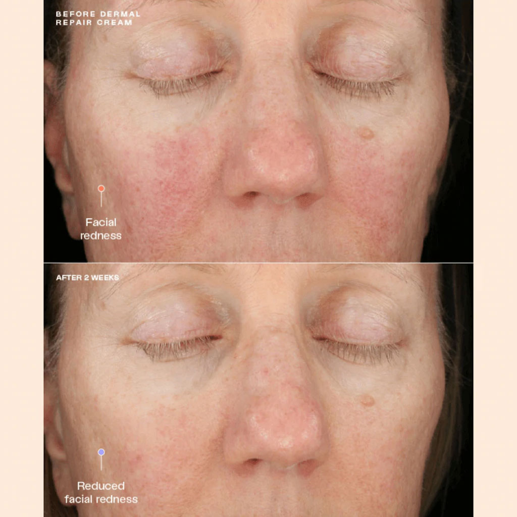Senté Dermal Repair Cream (1.7 oz) & Bio Complete Serum (0.33 oz) Duo.