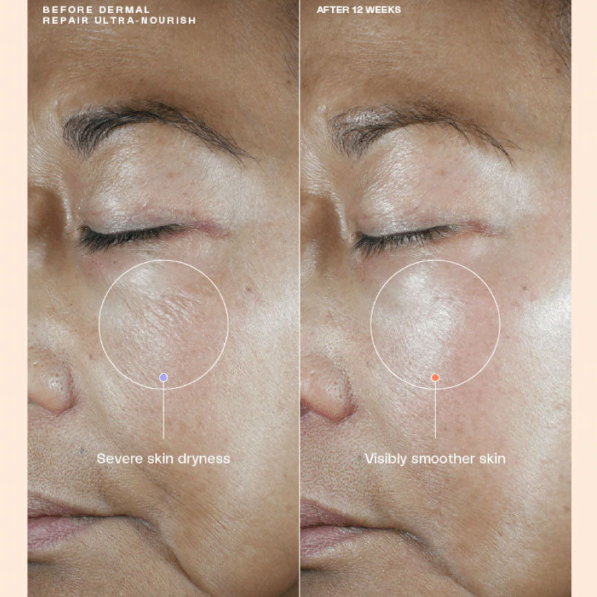 Senté Dermal Repair Ultra-Nourish (1.7 oz) & Bio Complete Serum (0.33 oz) Duo.