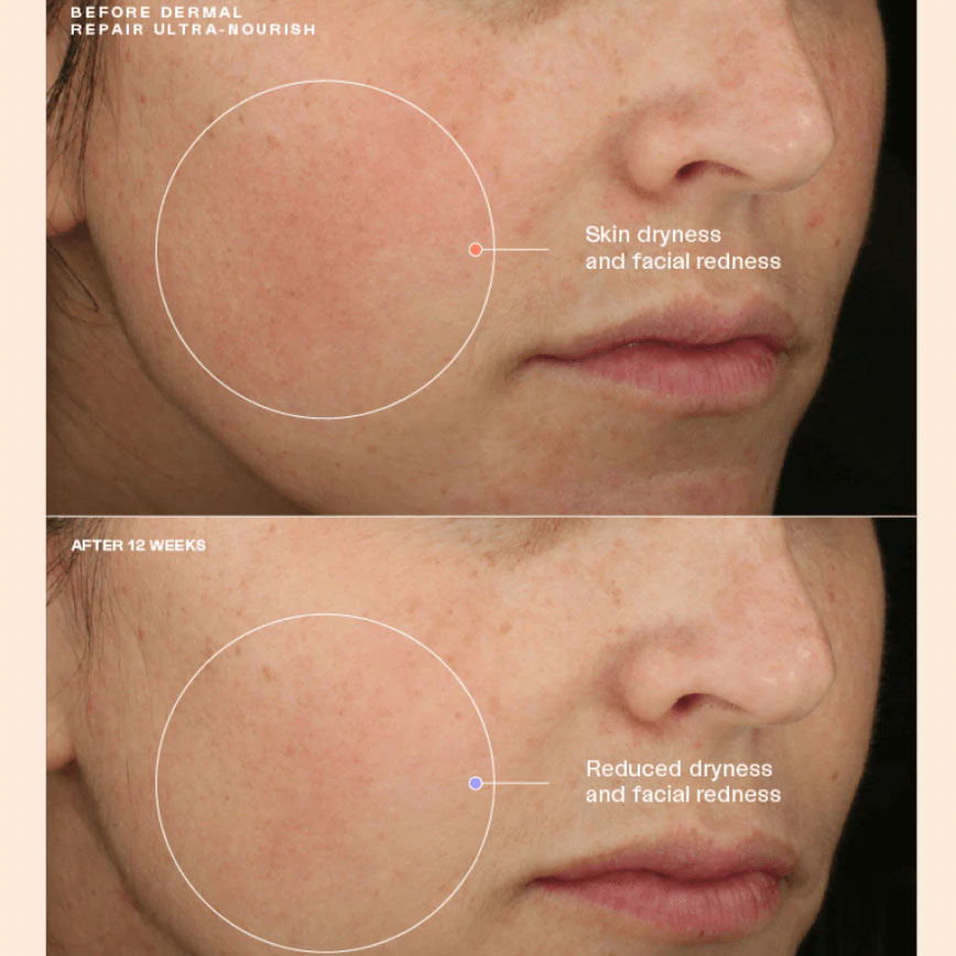 Senté Dermal Repair Ultra-Nourish (1.7 oz) & Bio Complete Serum (0.33 oz) Duo.