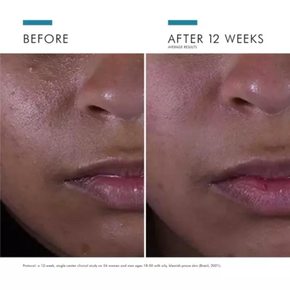 SkinCeuticals Silymarin CF (1 oz)