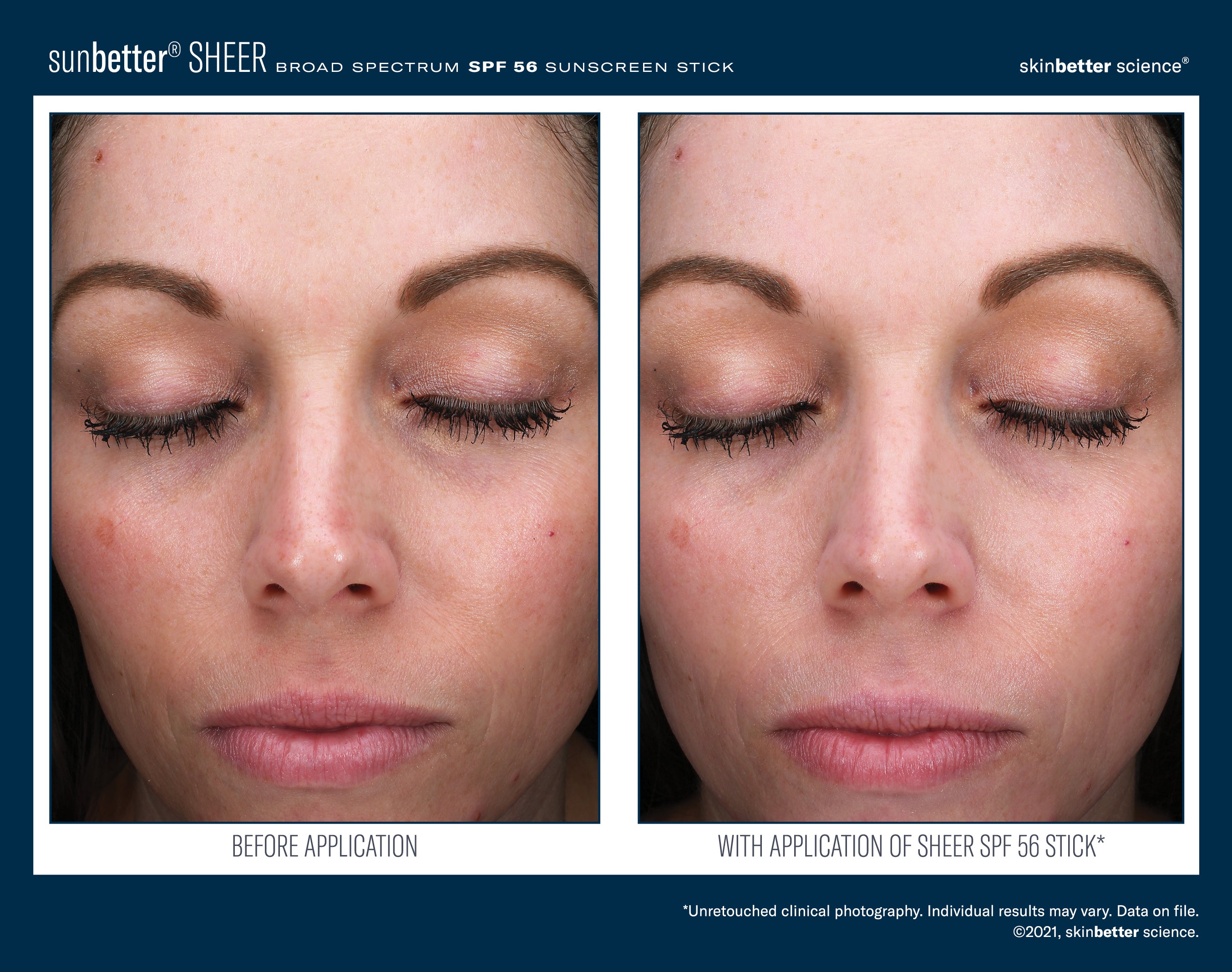 SkinBetter Science SunBetter SHEER SPF 56 Sunscreen Stick 20g