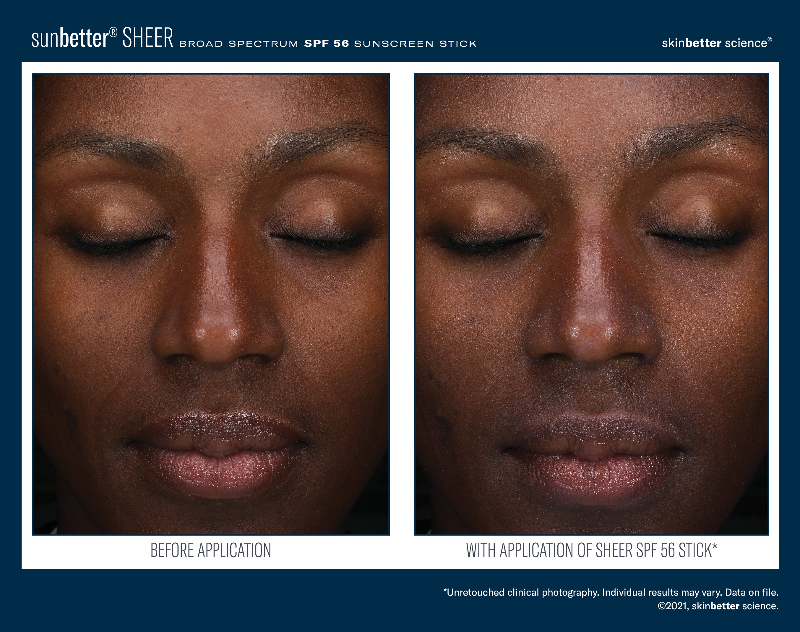 SkinBetter Science SunBetter SHEER SPF 56 Sunscreen Stick 20g