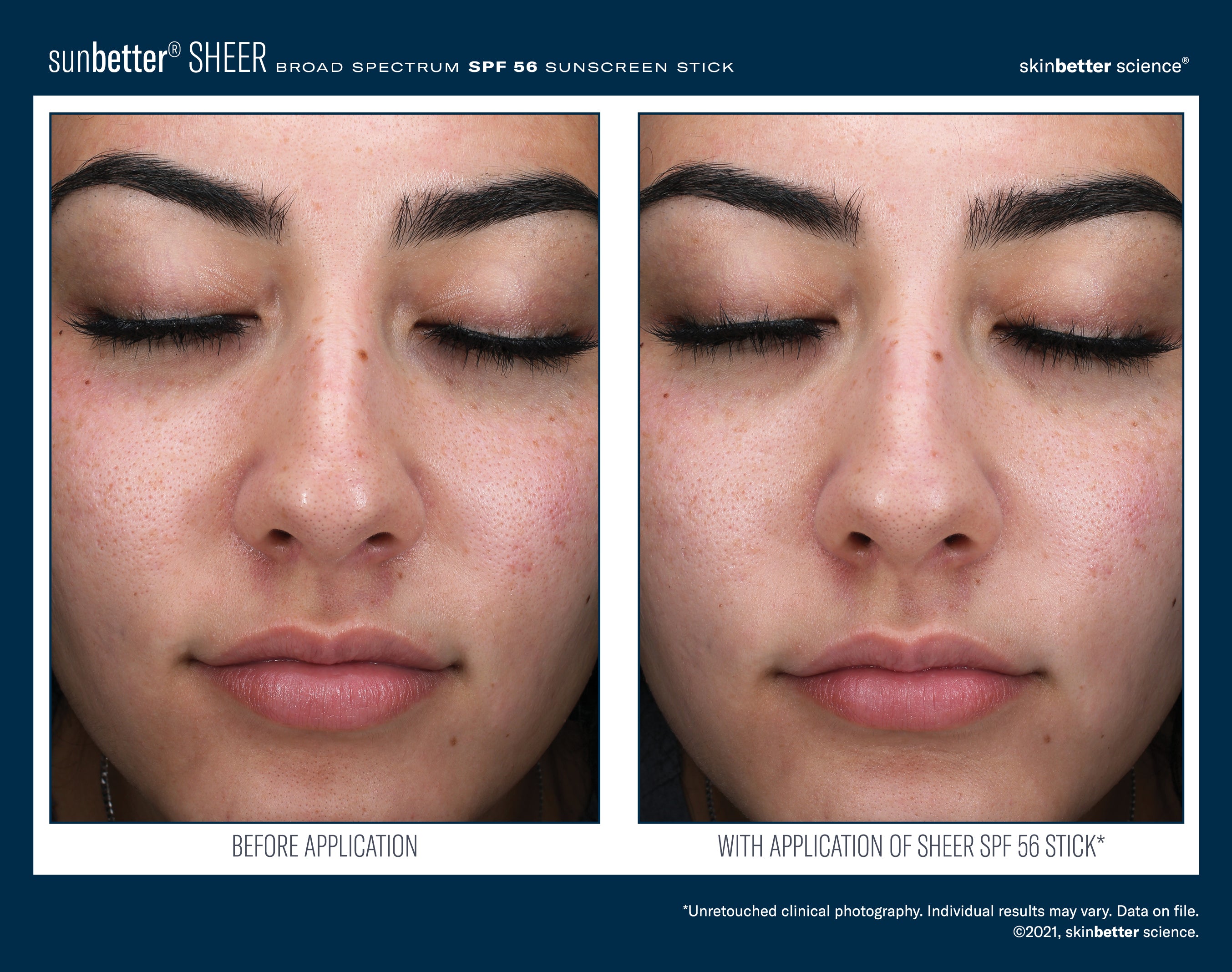 SkinBetter Science SunBetter SHEER SPF 56 Sunscreen Stick 20g