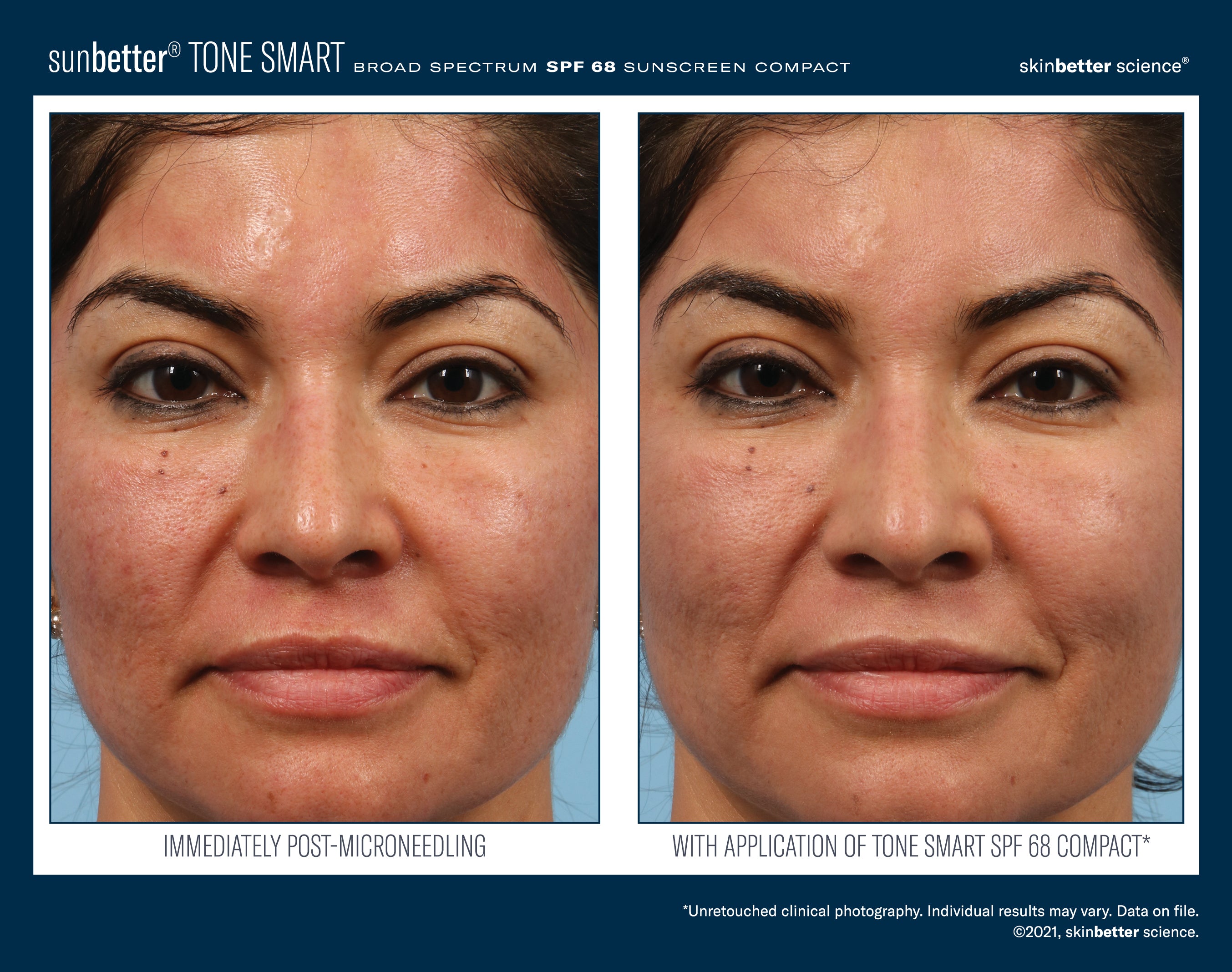 SkinBetter Science SunBetter TONE SMART SPF 68 Sunscreen Compact 12g