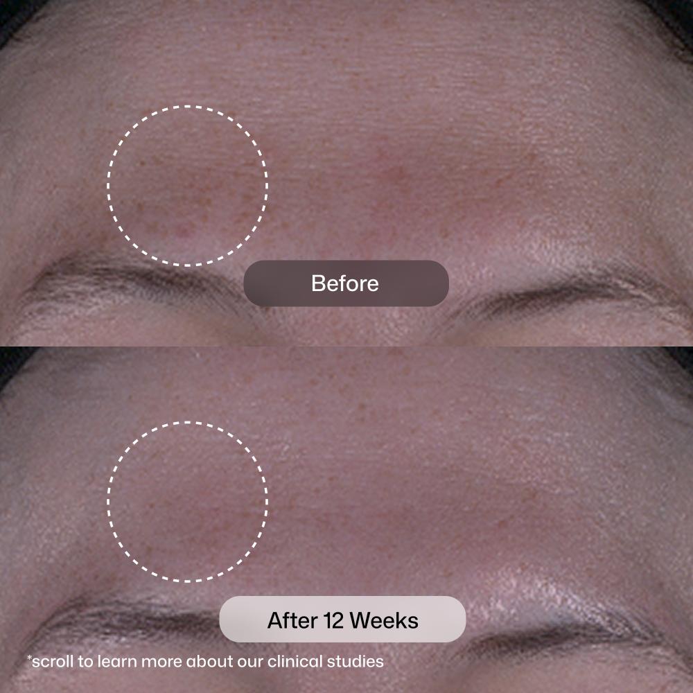 Revision Skincare Tone+ Correcting Pads (30 Pads).