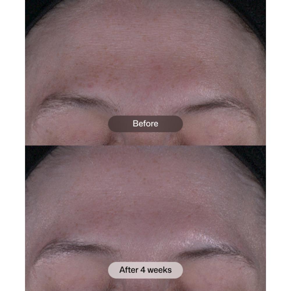 Revision Skincare Tone+ Correcting Pads (30 Pads).