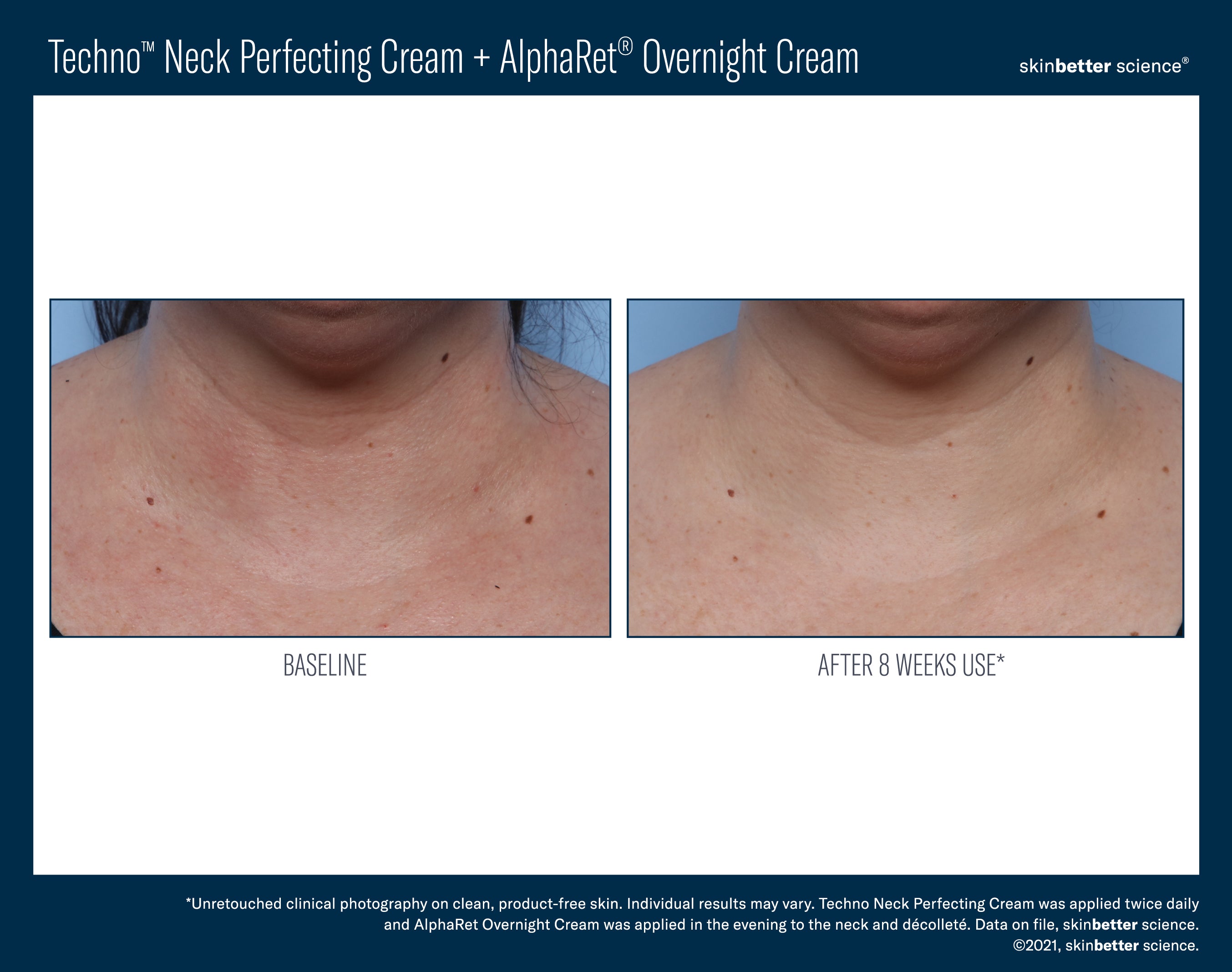 SkinBetter Science Travel Size Techno Neck Perfecting Cream (0.5 oz).