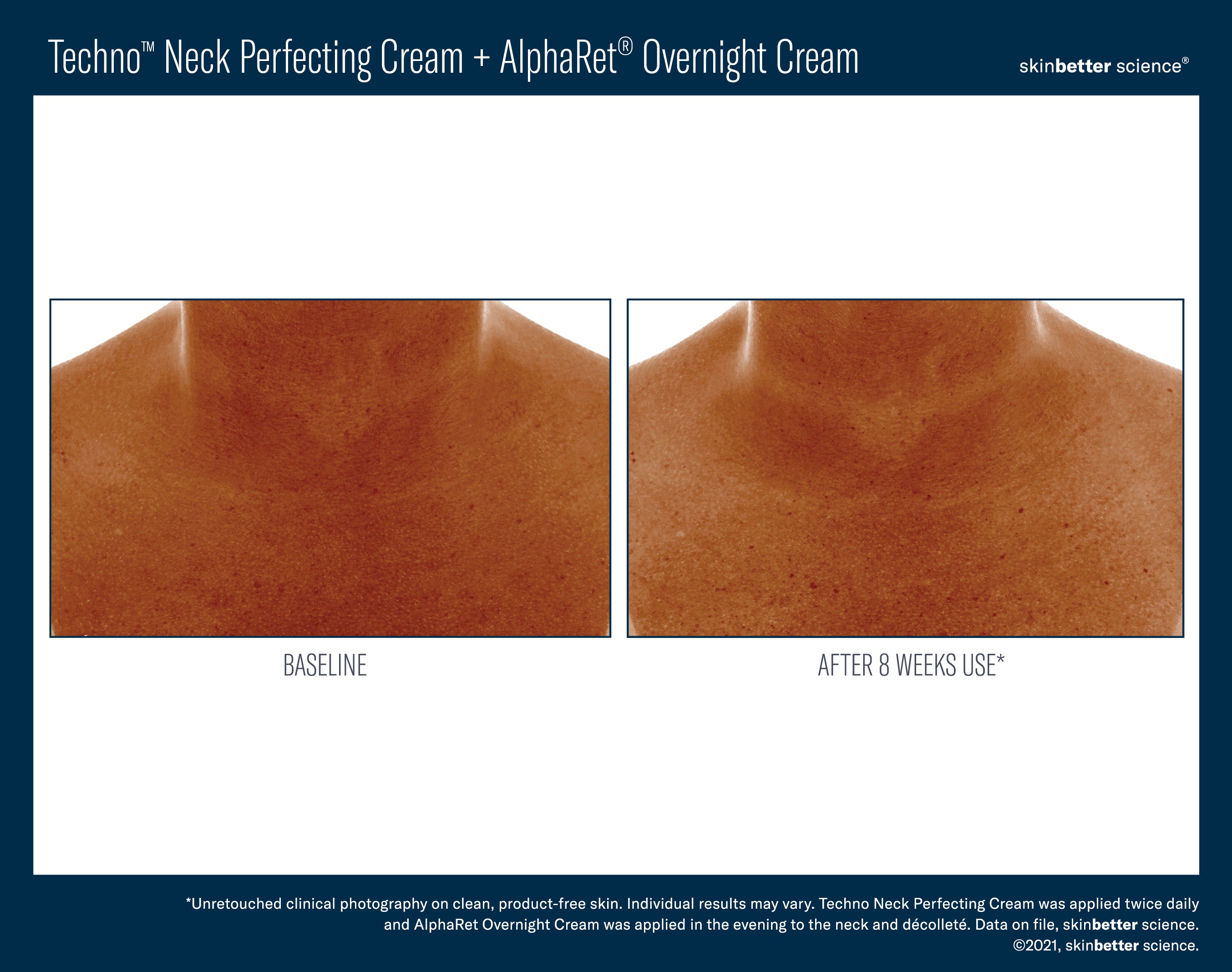 SkinBetter Science Travel Size Techno Neck Perfecting Cream (0.5 oz).