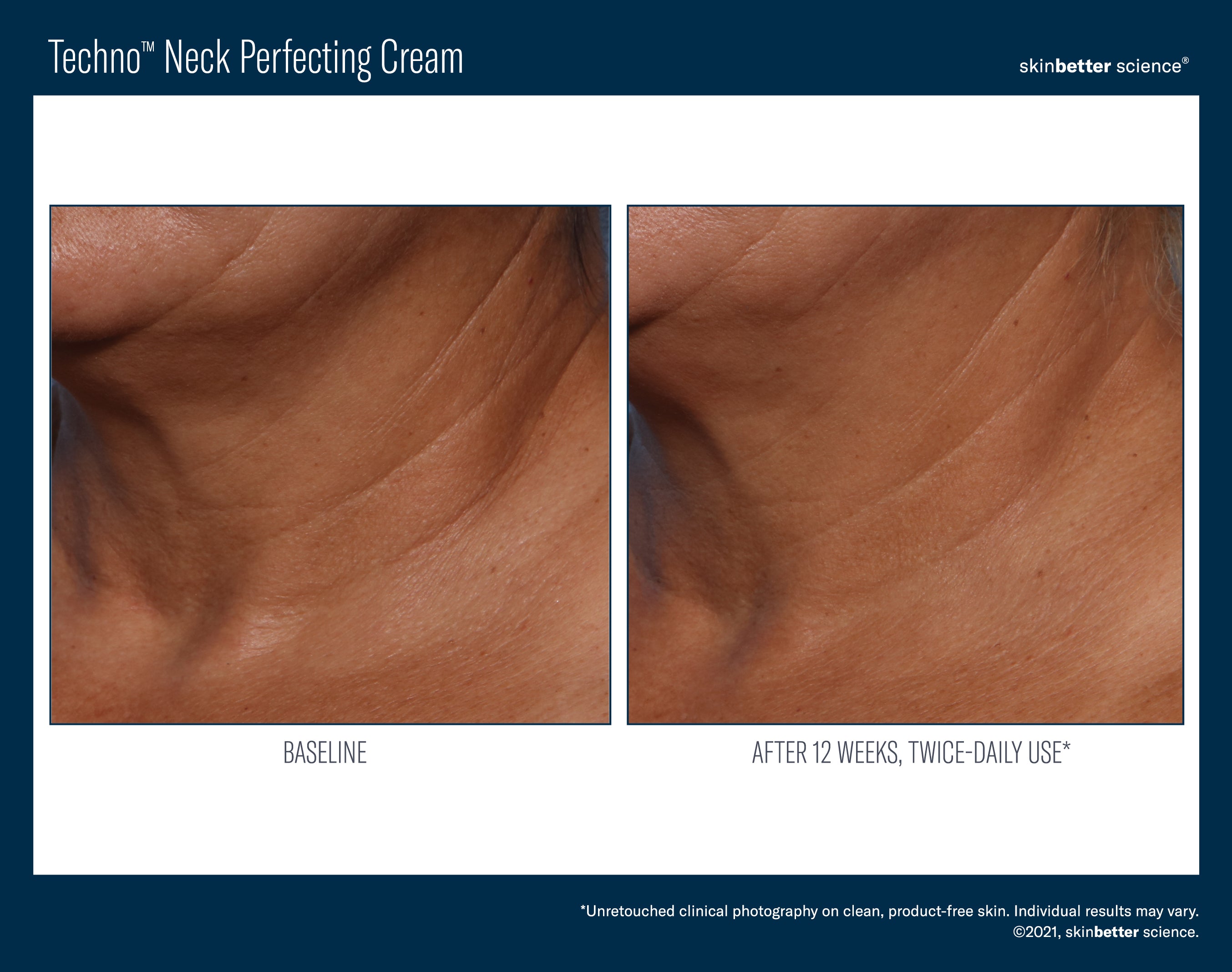 SkinBetter Science Travel Size Techno Neck Perfecting Cream (0.5 oz).