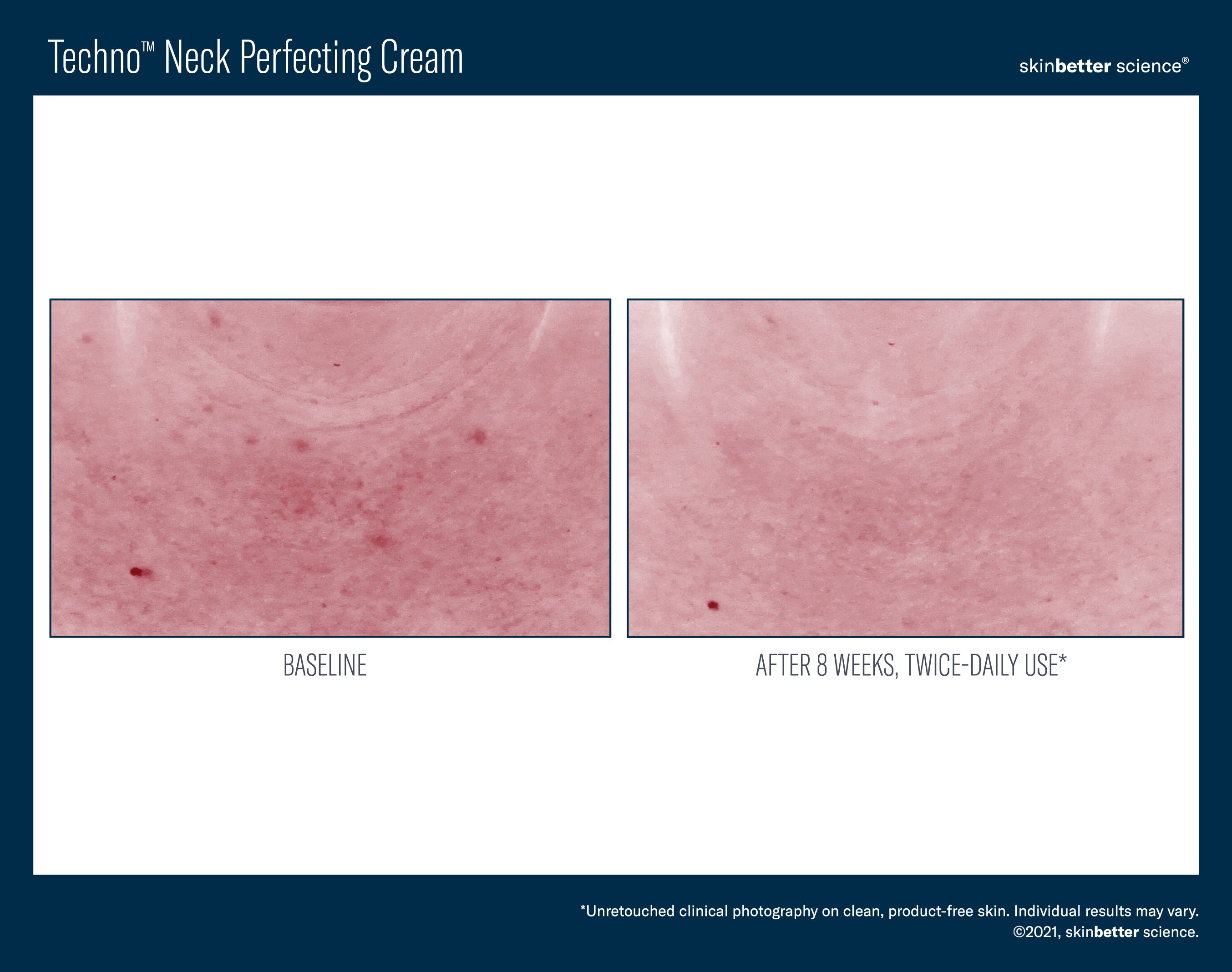 SkinBetter Science Techno Neck Perfecting Cream (1.69 oz)