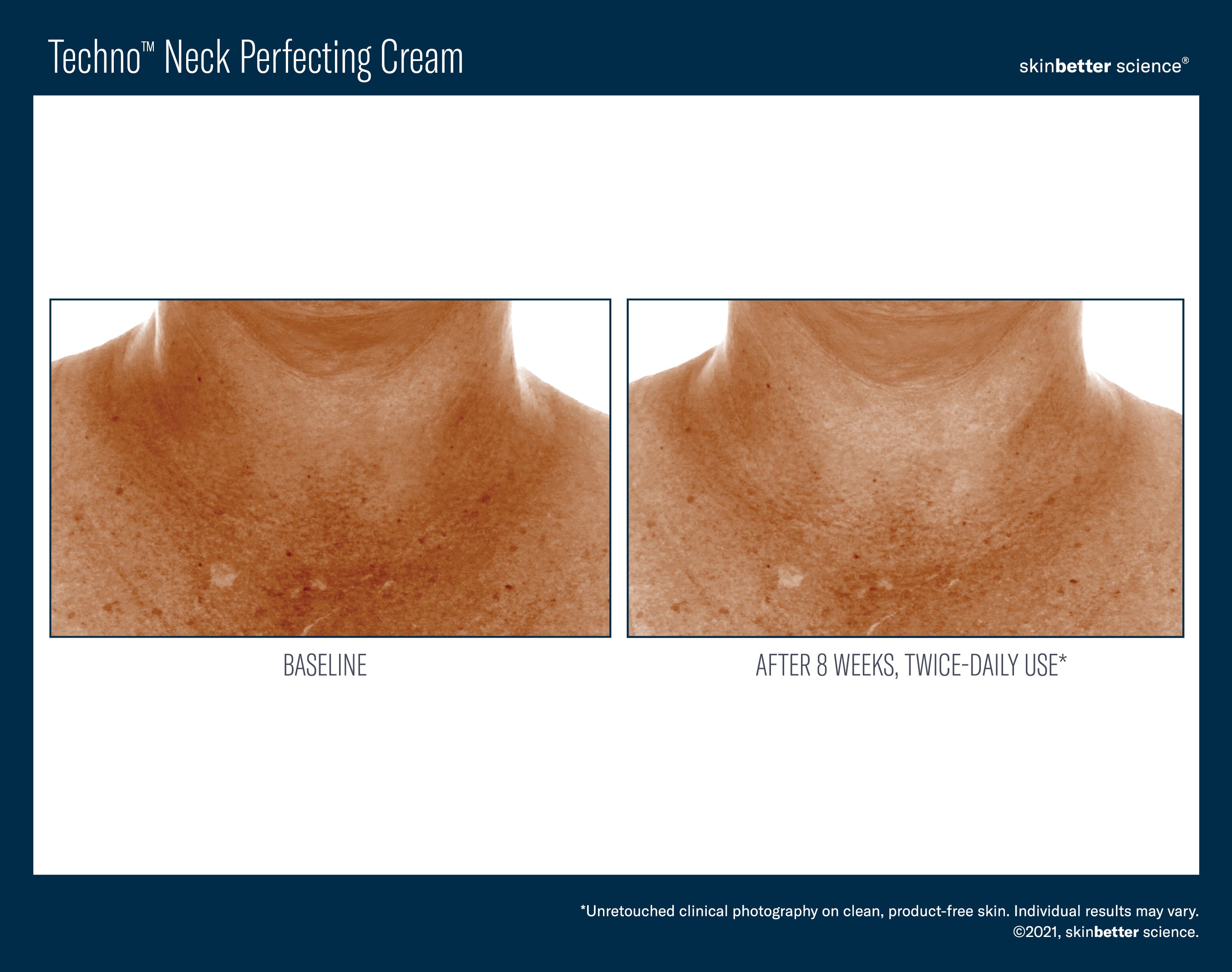 SkinBetter Science Travel Size Techno Neck Perfecting Cream (0.5 oz).