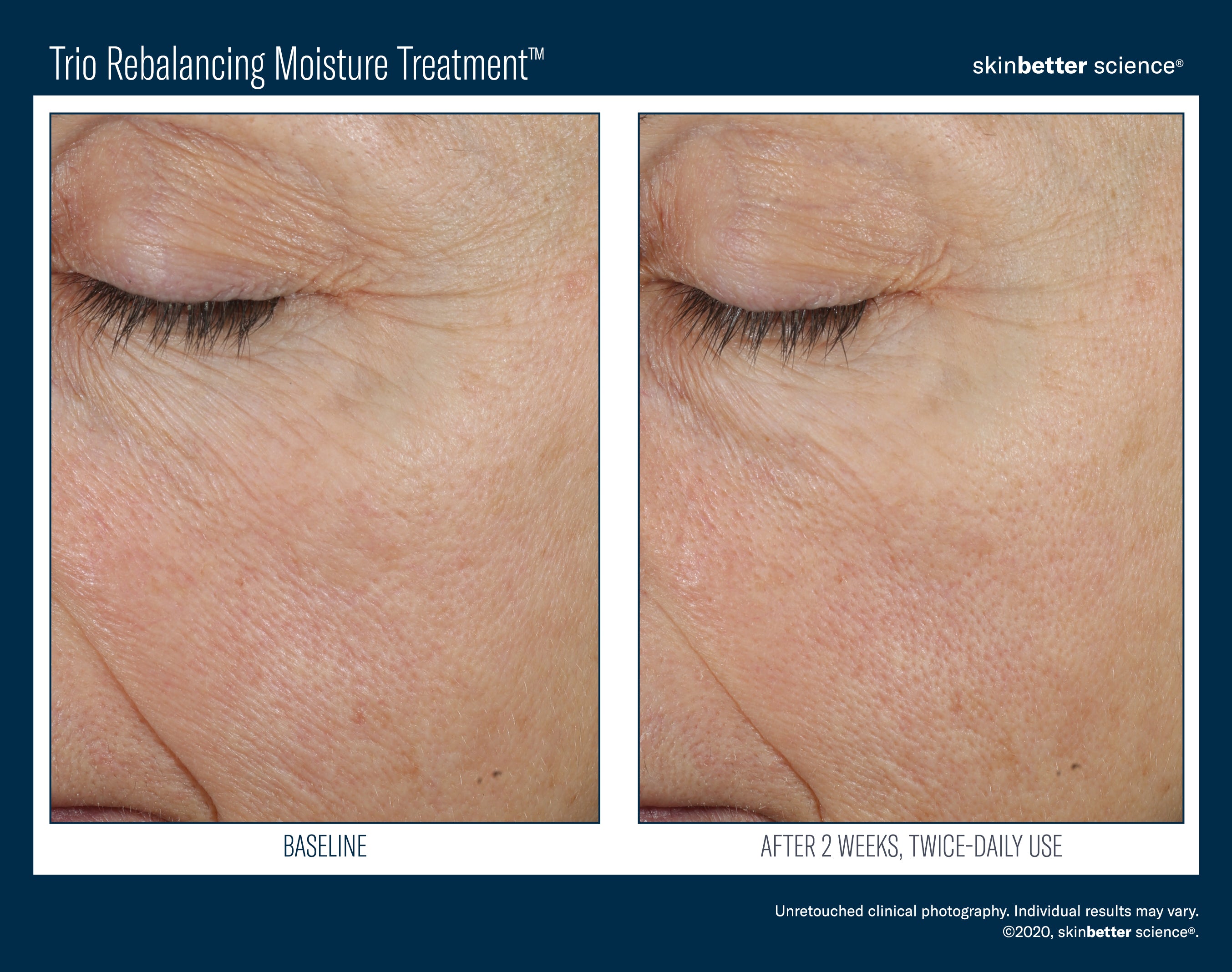 SkinBetter Science Travel Size Trio Rebalancing Moisture Treatment (0.5 oz)