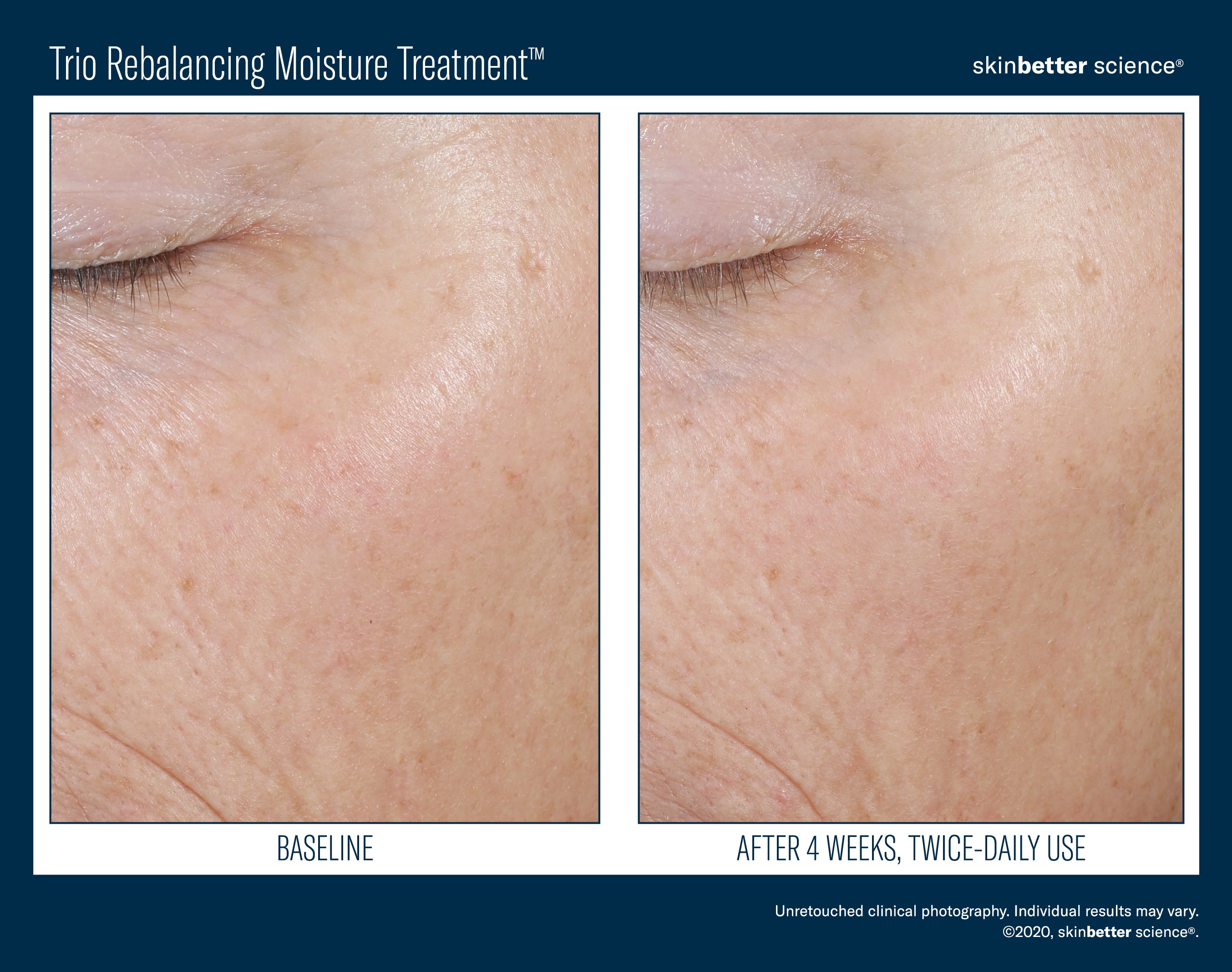 SkinBetter Science Trio Rebalancing Moisture Treatment (0.17 oz)