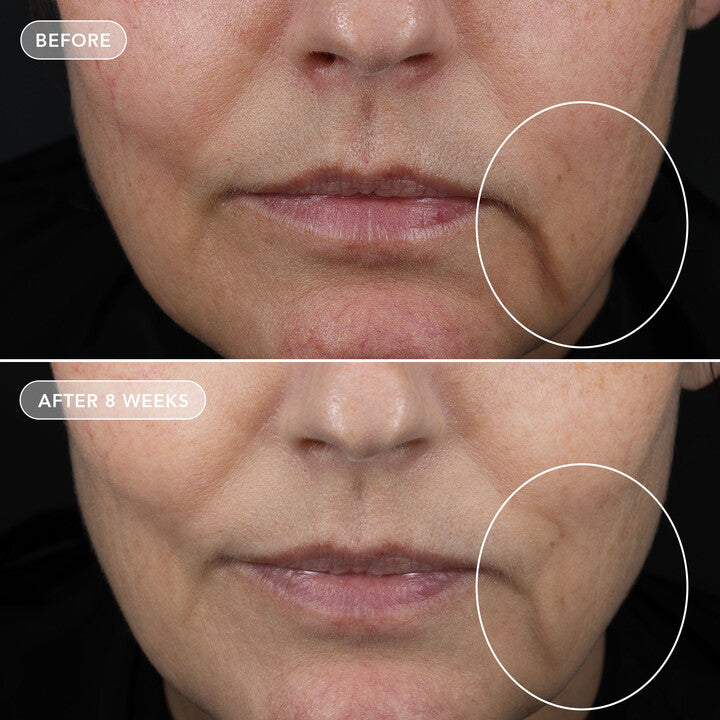 IMAGE Skincare VOL.U.LIFT GLP-1 4D Skin Rebound Complex (2 oz)