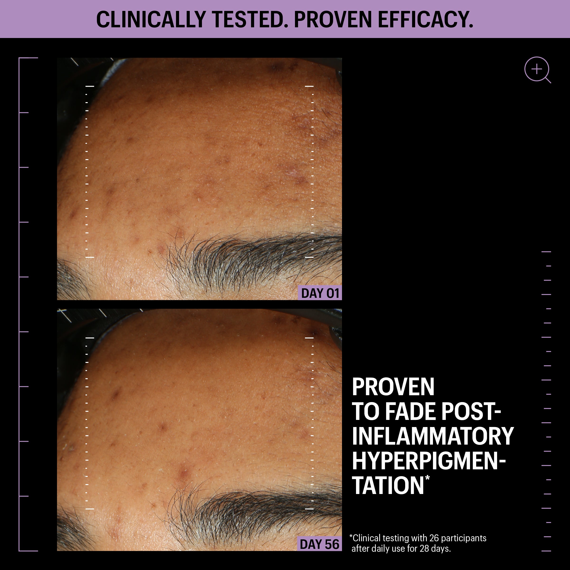 Allies of Skin Azelaic and Kojic Advanced Clarifying Serum (1 oz).