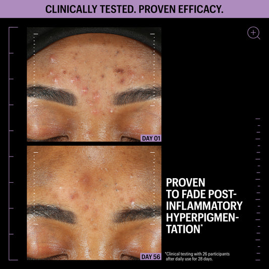 Allies of Skin Azelaic and Kojic Advanced Clarifying Serum (1 oz).