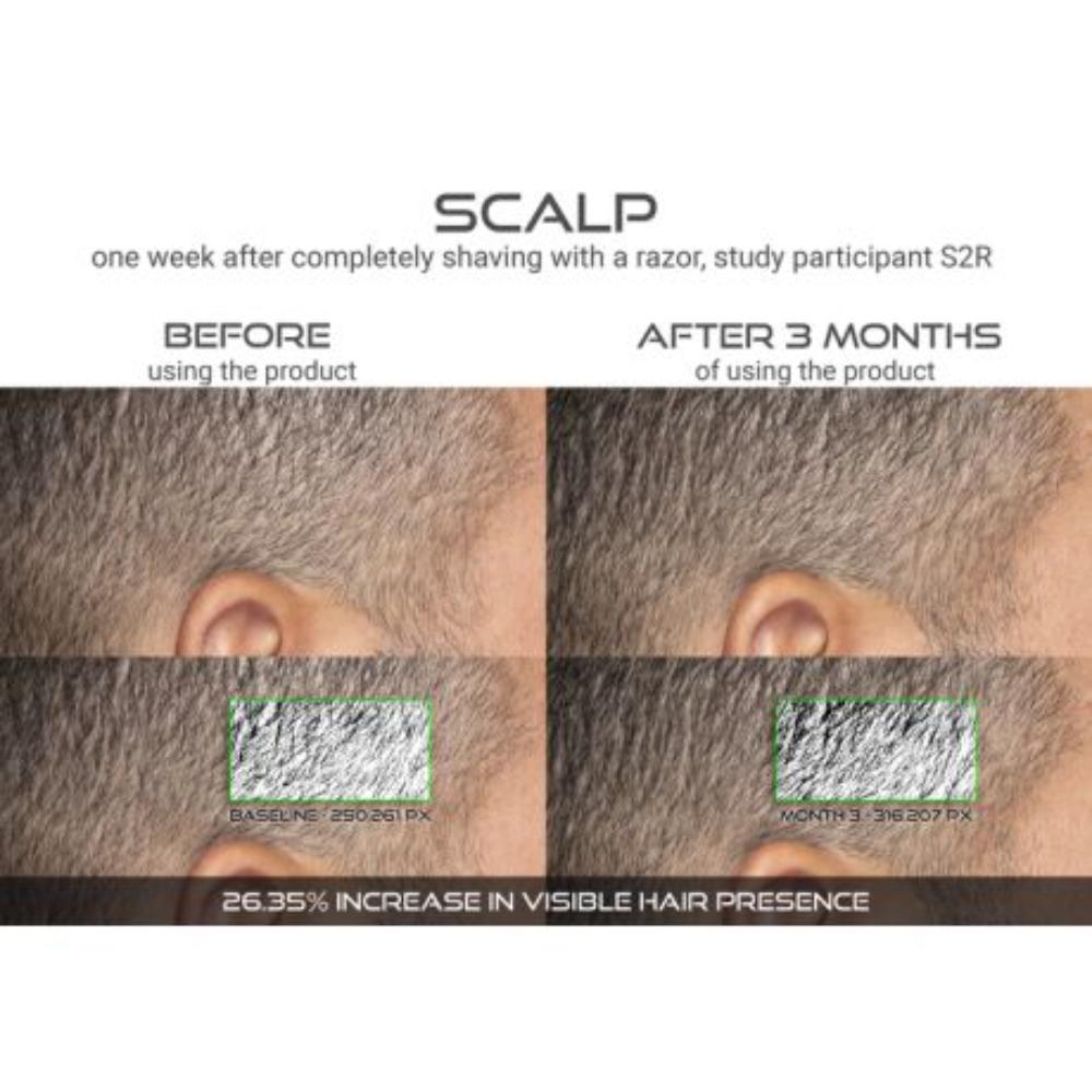 DefenAge 150K Hair Follicle Serum - Men's Edition | 1 Month Supply (1 oz)