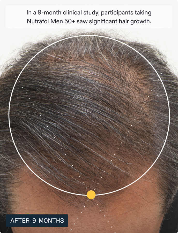 Nutrafol Men's For Men 50+ Hair Growth Nutraceutical (120 Capsules).