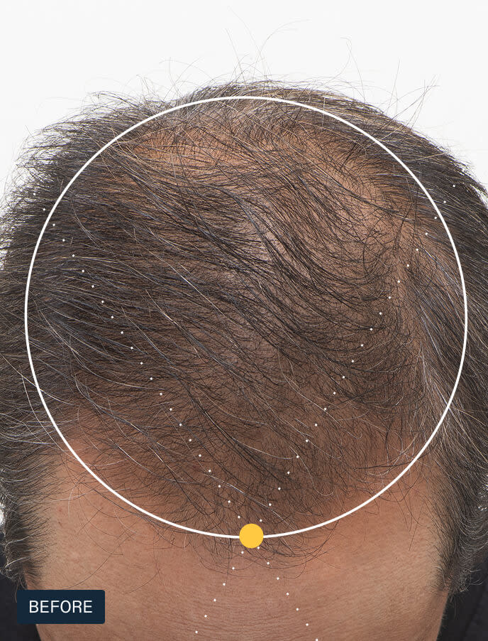 Nutrafol Men's For Men 50+ Hair Growth Nutraceutical (120 Capsules).