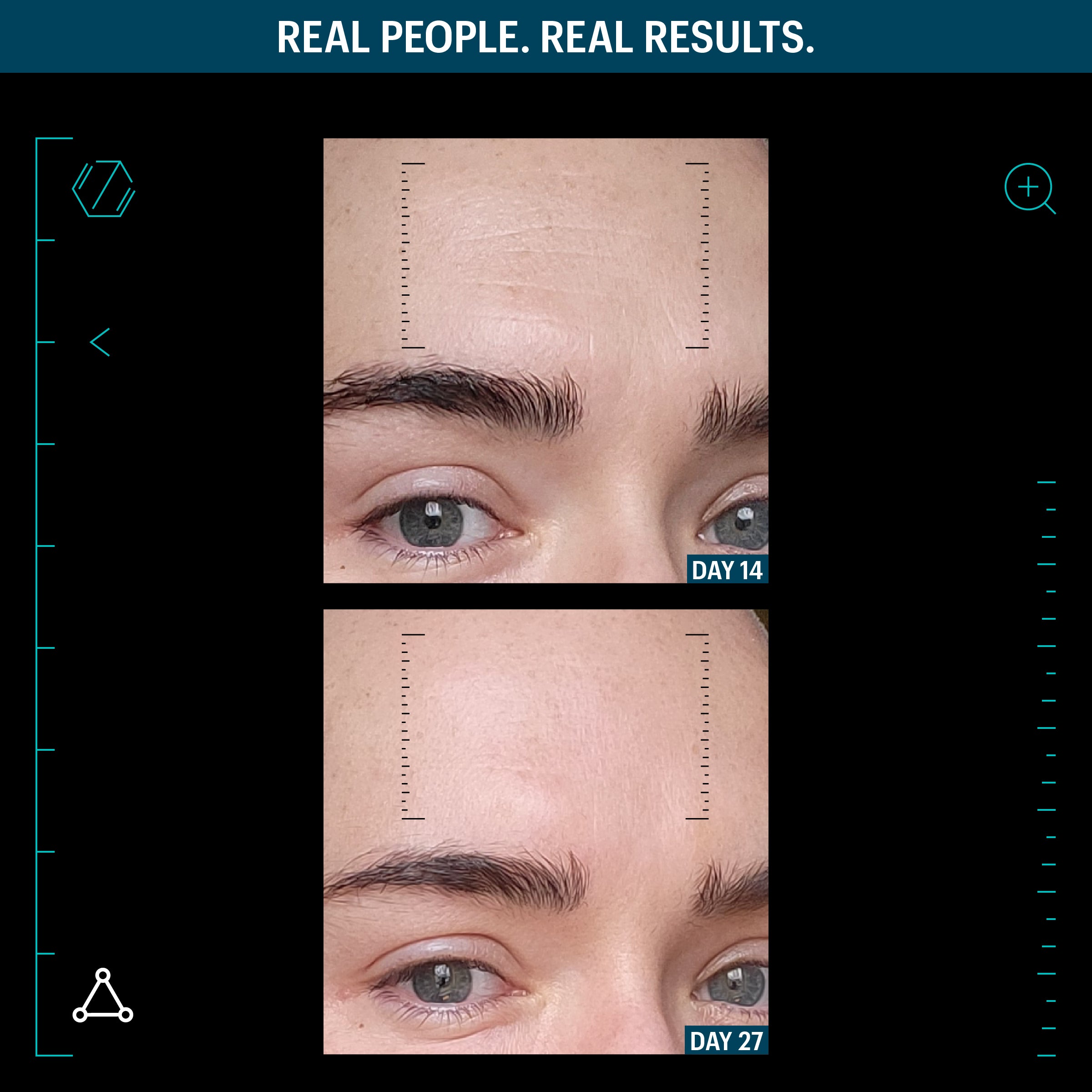 Allies of Skin Multi Peptides and Growth Factor Advanced Lifting Serum (1.7oz)